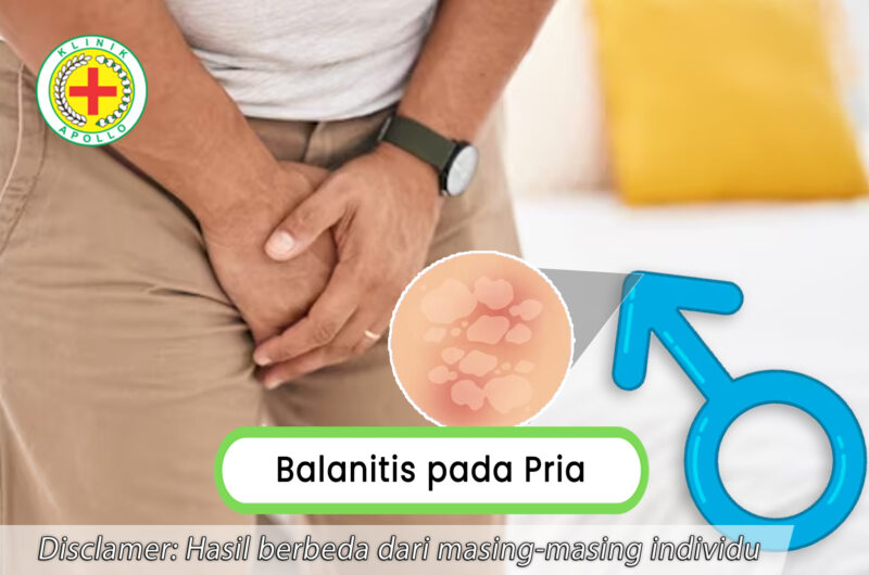 Penyebab Infeksi Serta Cara Pencegahan Balanitis Pada Pria Klinik