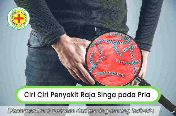 Kenali Tanda Gejala Dan Ciri Ciri Penyakit Raja Singa Pada Pria