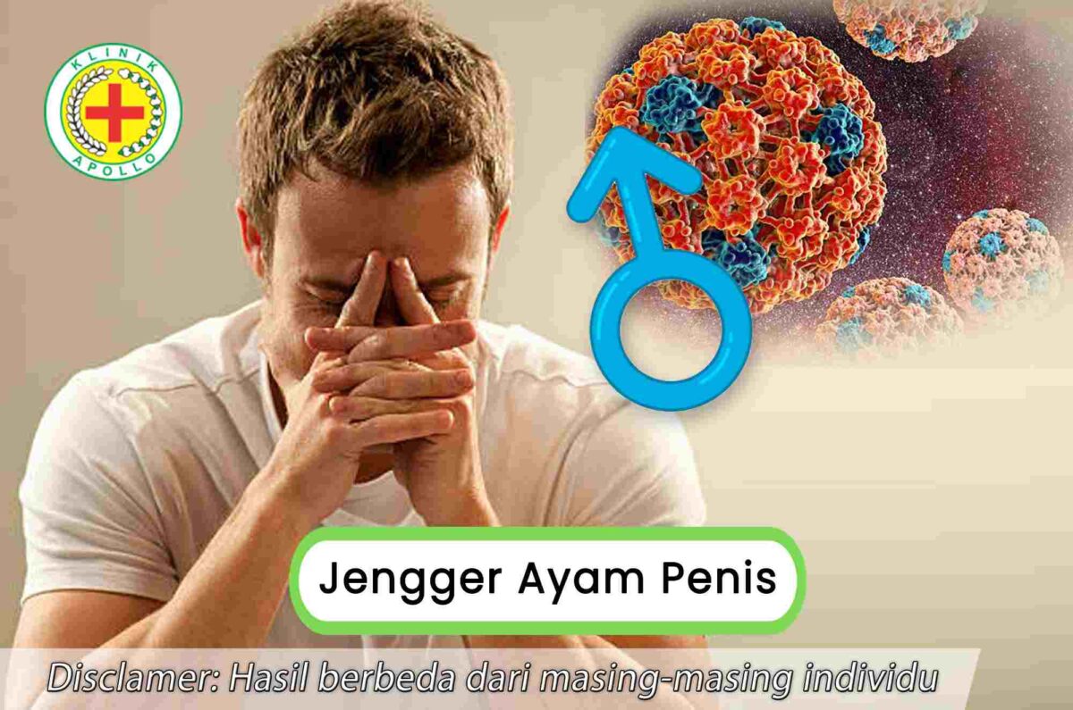 Apa Itu Jengger Ayam Penis Bagaimana Cara Mengelolanya Klinik