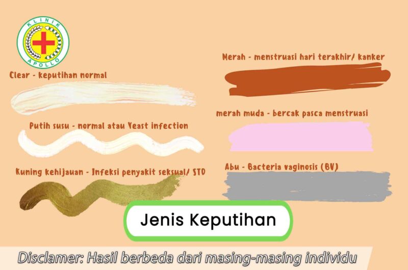 6 Jenis Keputihan, Dari Yang Normal Hingga Berbahaya | Klinik Apollo ...