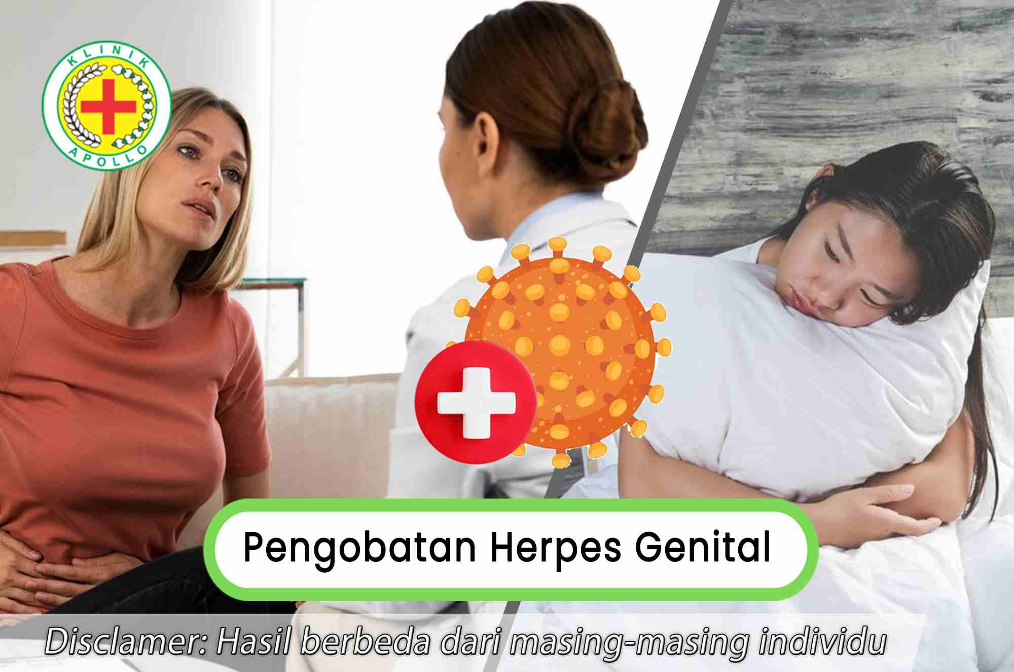 Bisa Menyerang Wanita, Begini Pengobatan untuk Herpes Genital