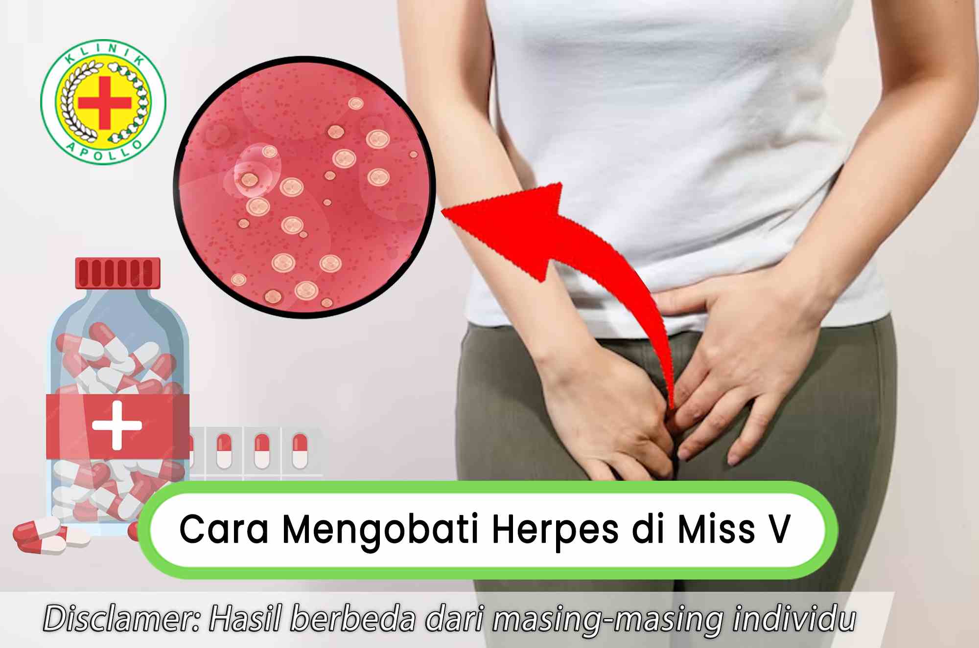 Konsultasikan dengan dokter ahli dan ketahui cara mengobati herpes di miss v.