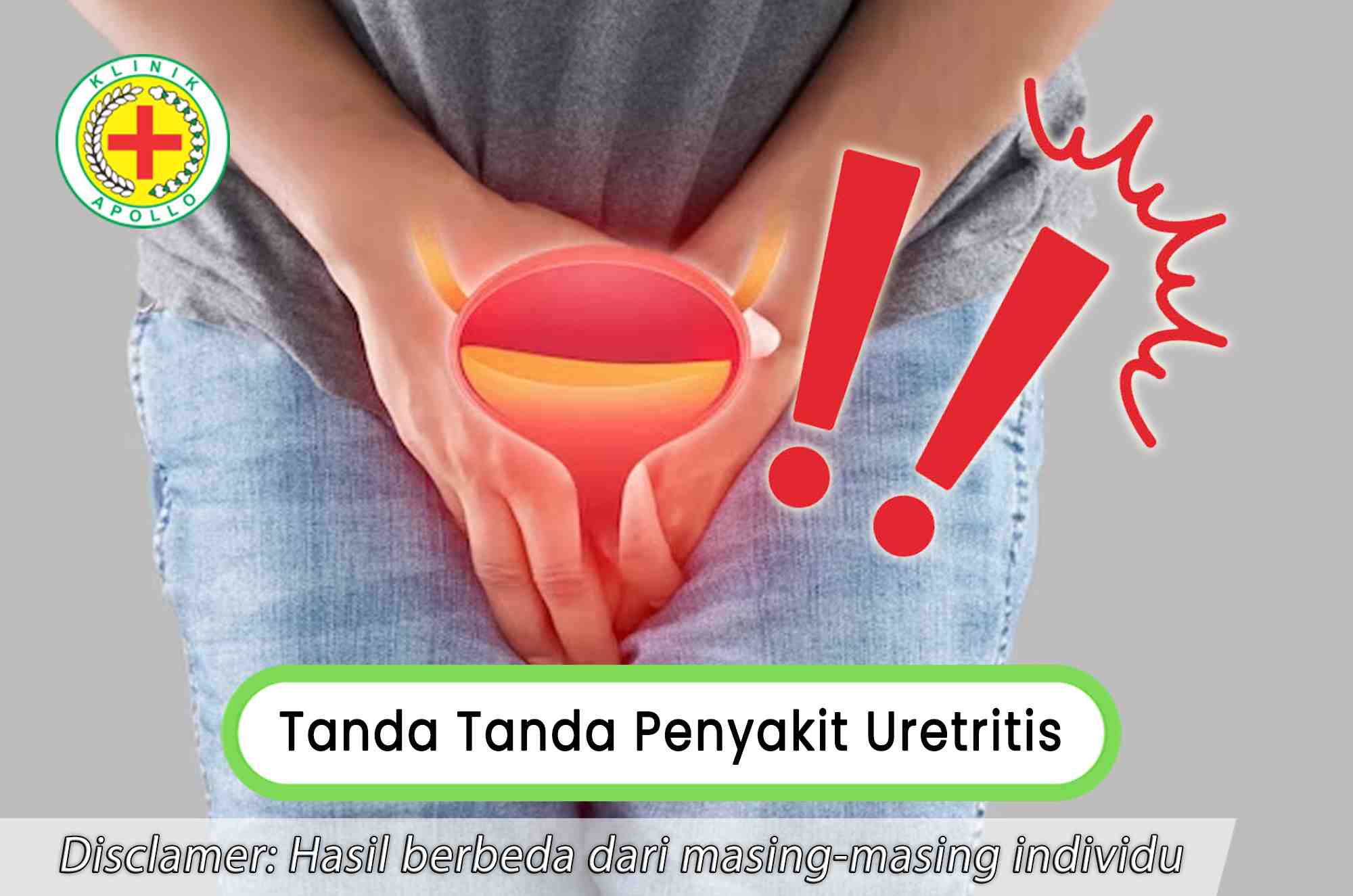 Untuk mengetahui tanda tanda uretritis memerlukan pemeriksaan medis di Klinik Apollo Jakarta.