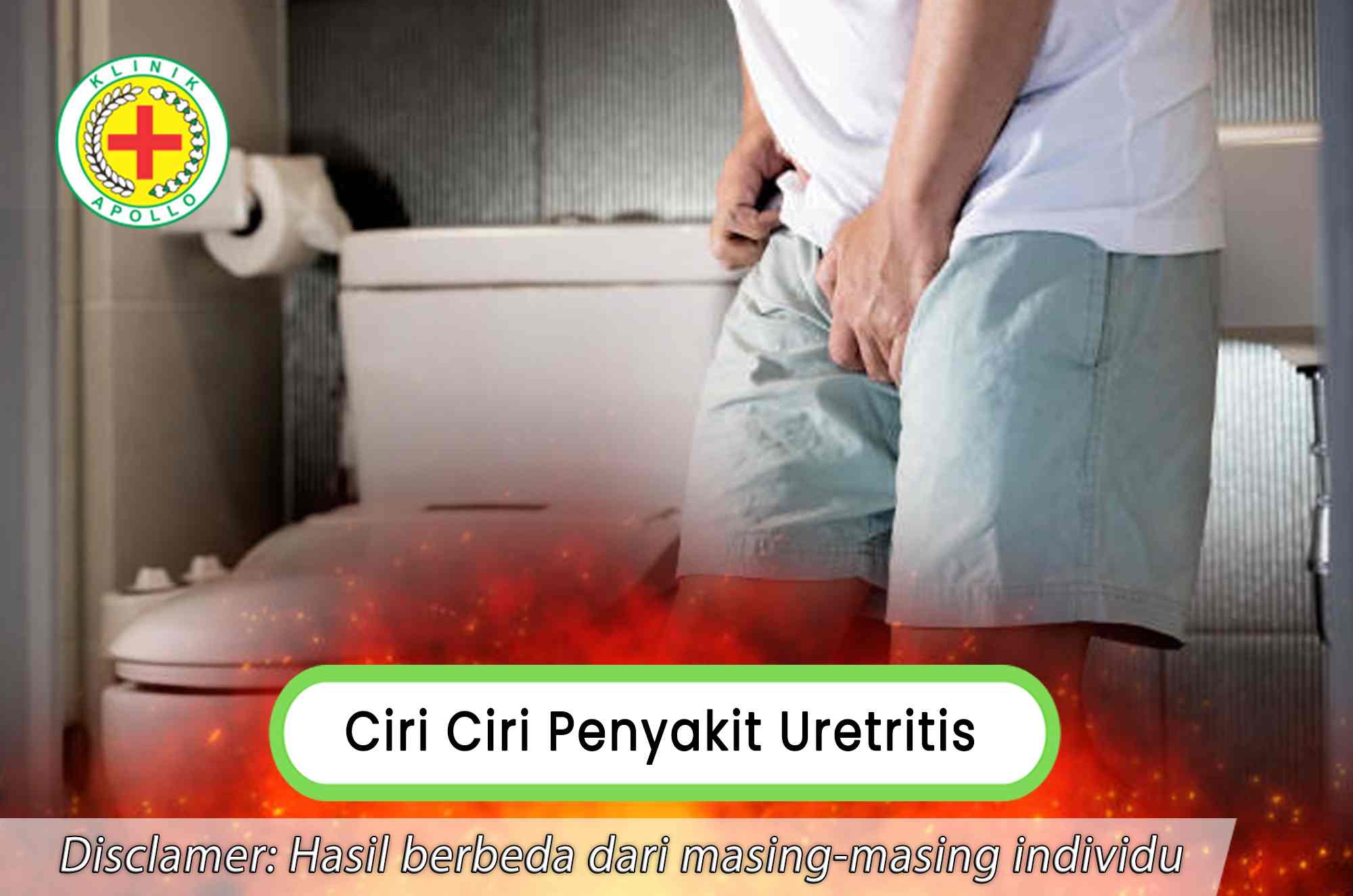 Sebelum melakukan pengobatan lebih lanjut, kenali ciri ciri penyakit uretritis lebih rinci.