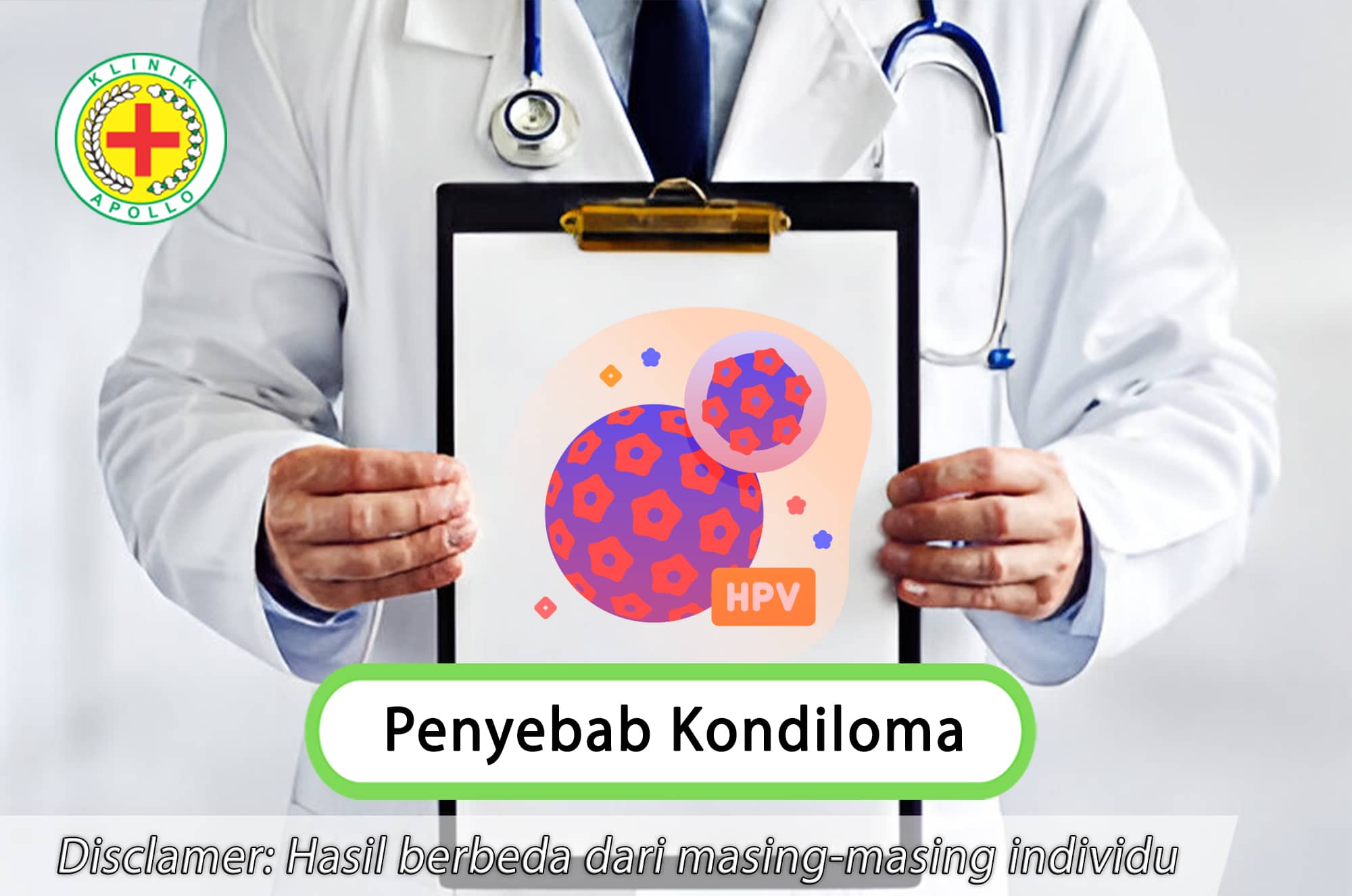 Temukan penyebab kondiloma dan solusi terbaik di Klinik Apollo untuk penanganan lebih lanjut.