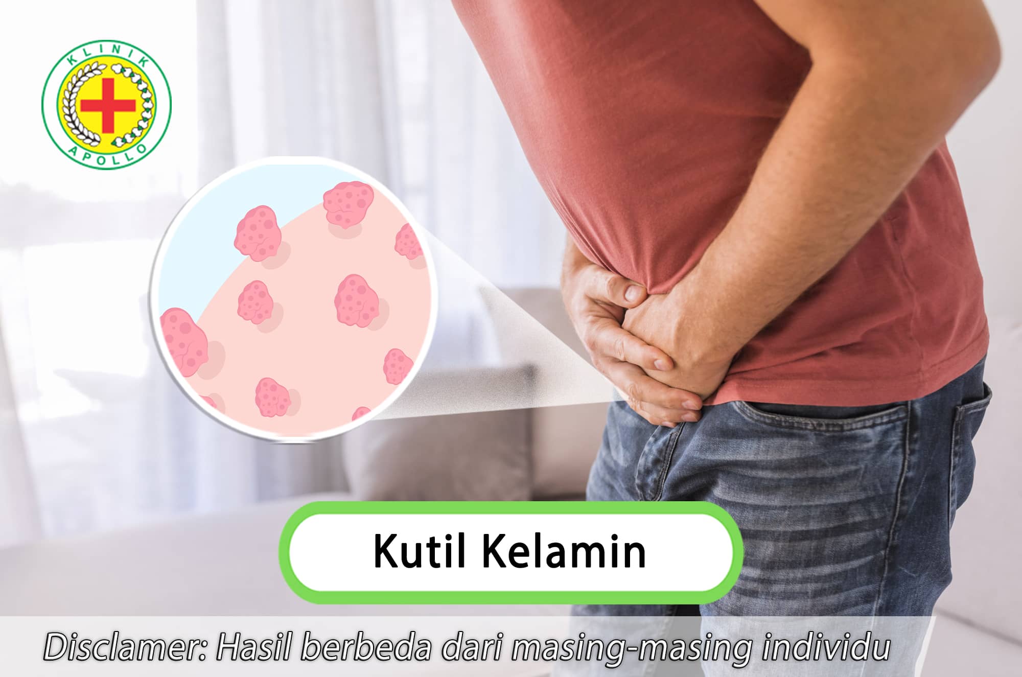 Jangan abaikan kutil kelamin, atasi masalah ini di Klinik Apollo untuk penanganan lebih lanjut.