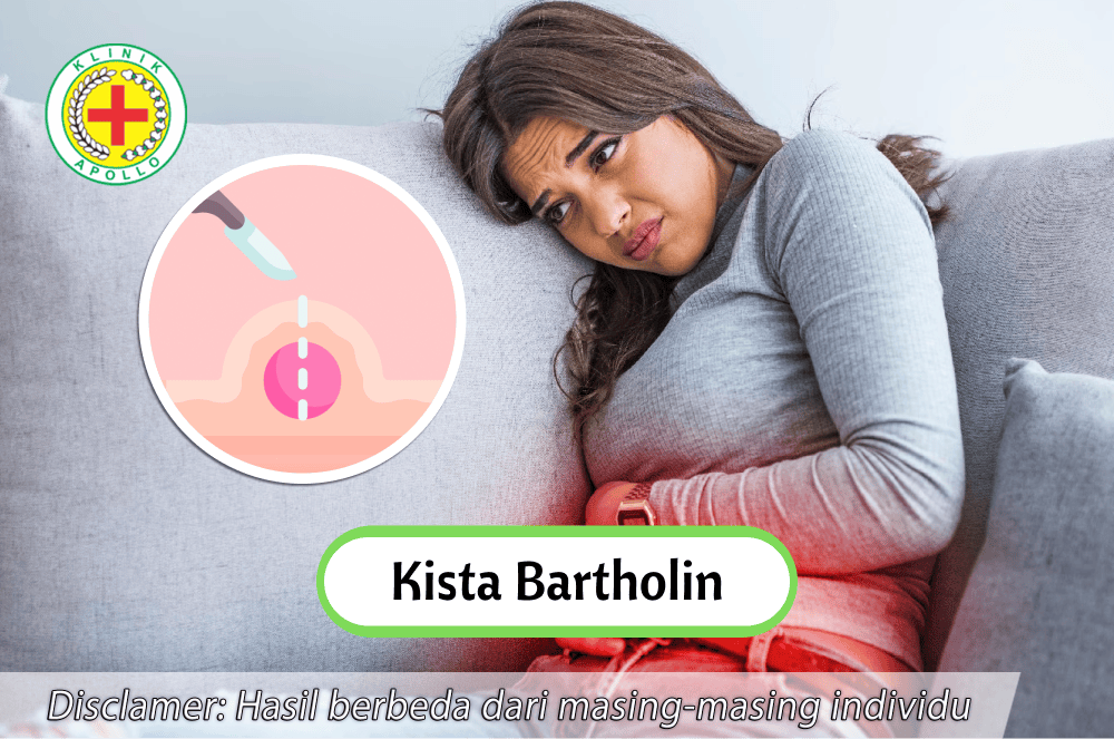 Tidak perlu khawatir, kista bartholin pada wanita dapat disembuhkan di Klinik Apollo.