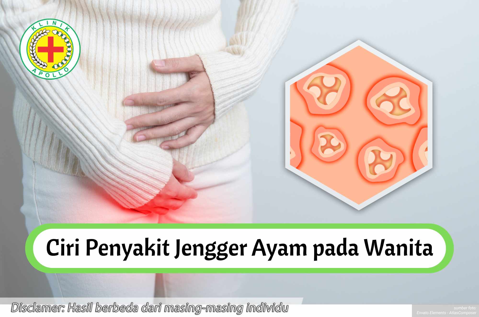 Ketahui ciri penyakit jengger ayam dengan pemeriksaan medis di Klinik Apollo.