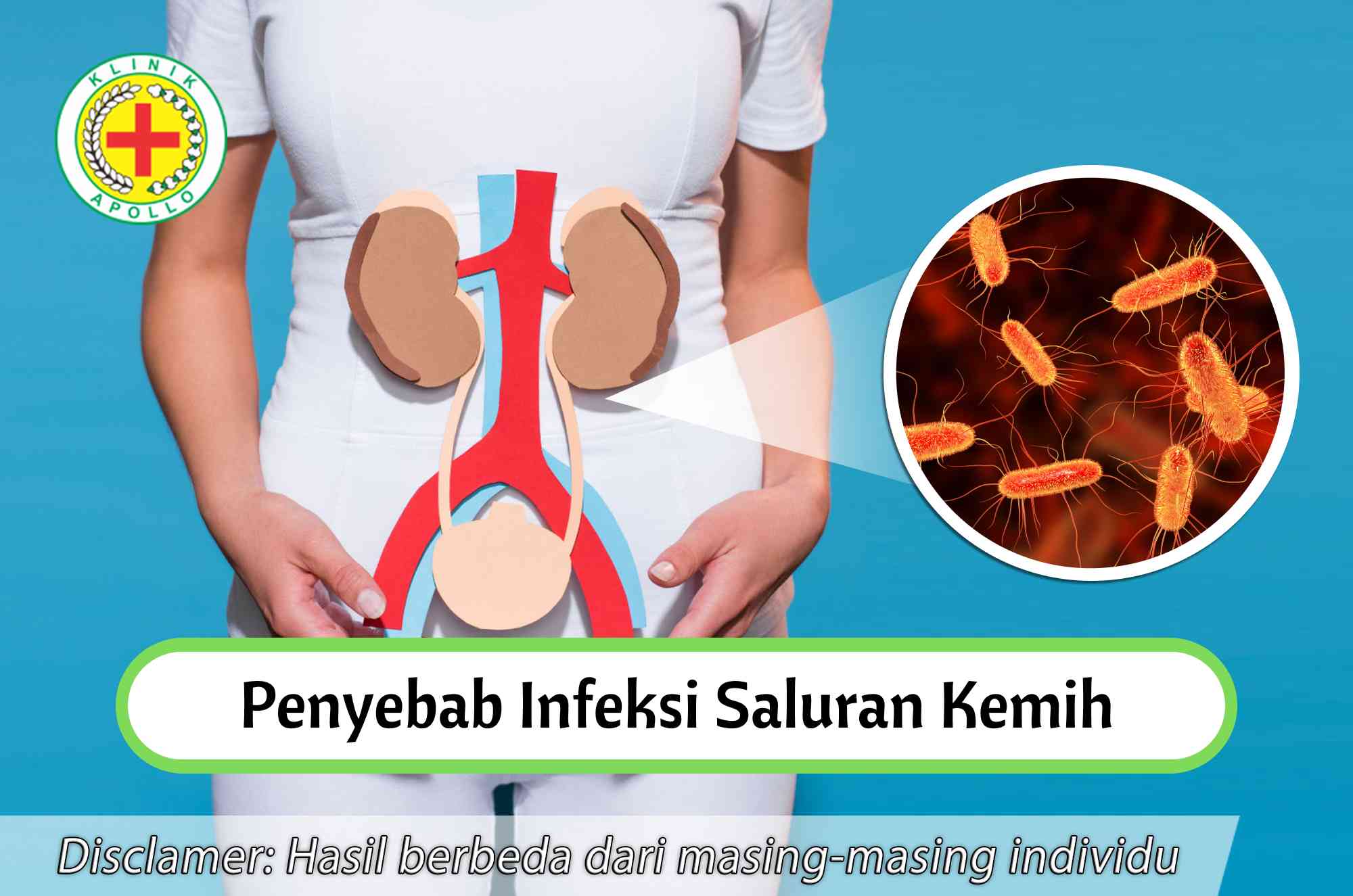 Ketahui Penyebab Infeksi Saluran Kemih Dan Cara Mengobatinya Klinik 