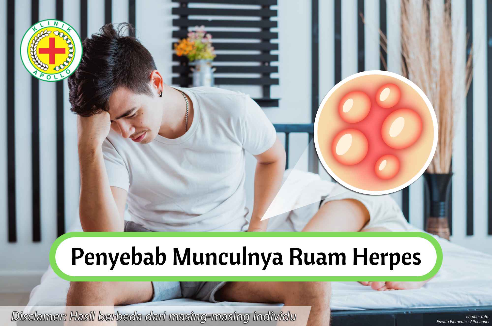 Setelah melakukan pemeriksaan medis, kenali penyebab munculnya ruam herpes dengan tepat.