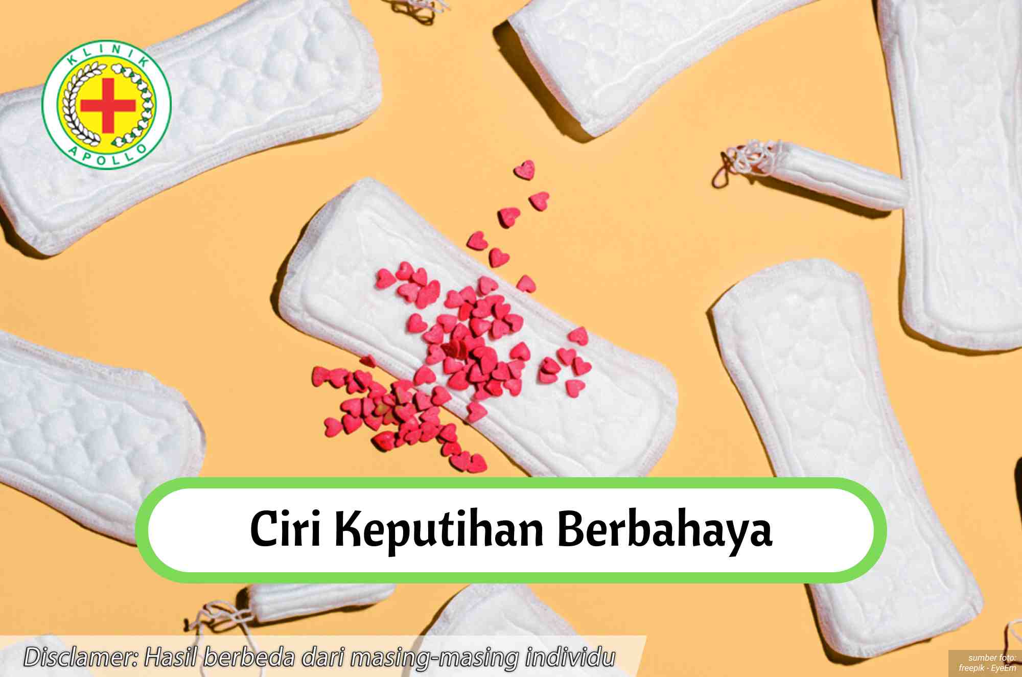 Ilustrasi Ciri Keputihan Berbahaya yang Harus Segera Diobati.