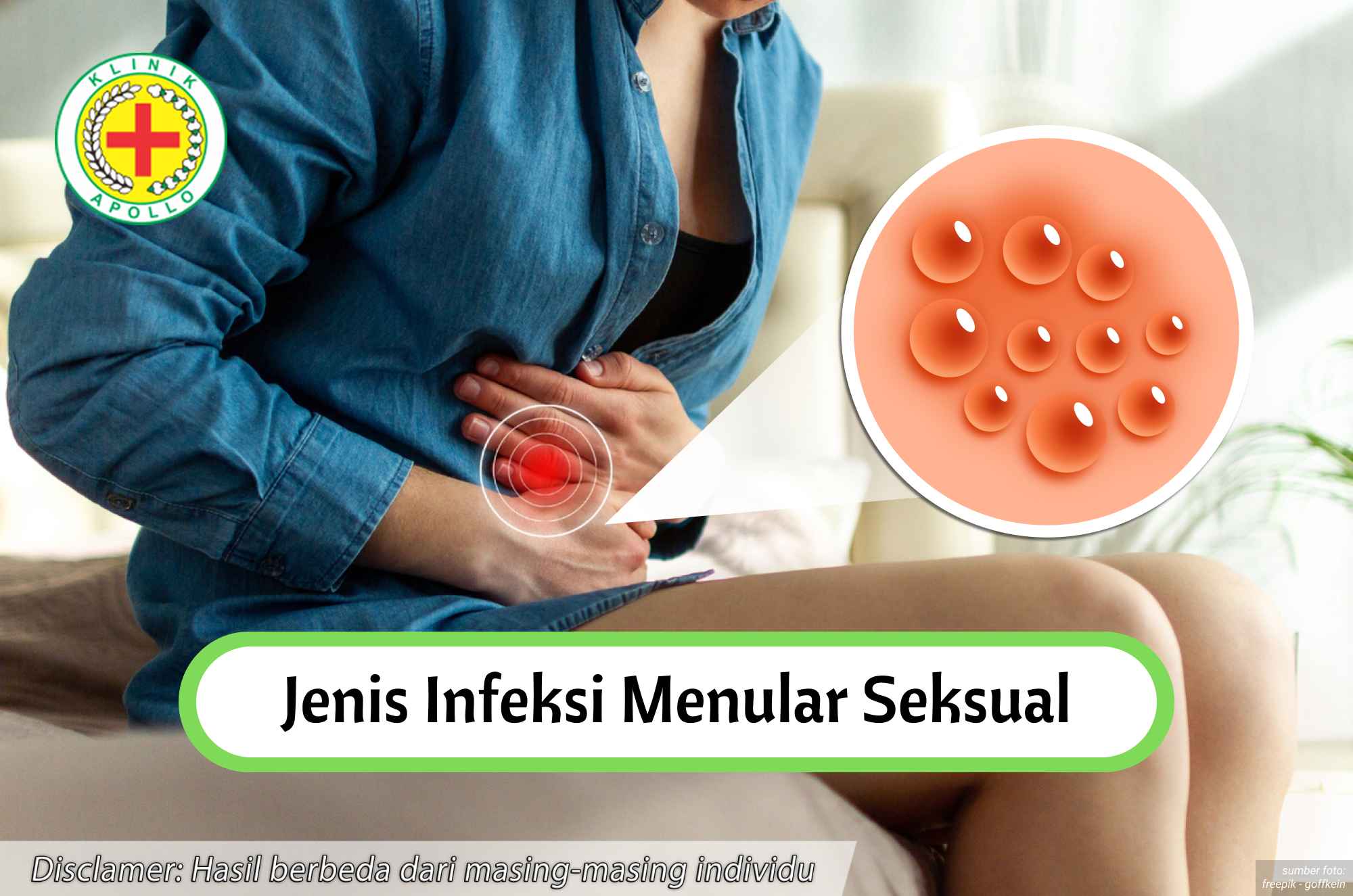 Ilustrasi Seorang Wanita dengan Berbagai Jenis Infeksi Menular Seksual.