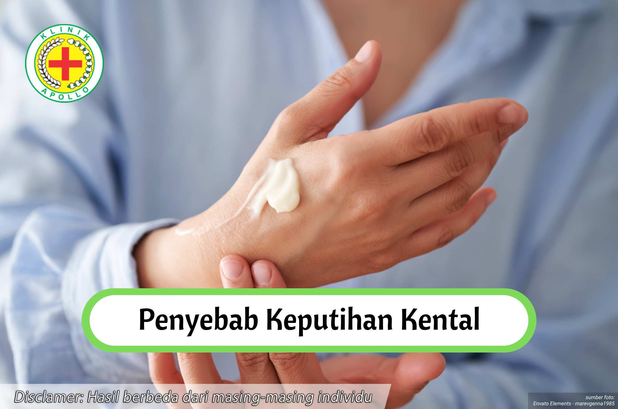 Ketahui penyebab keputihan kental dengan melakukan pemeriksaan medis di Klinik Apollo.