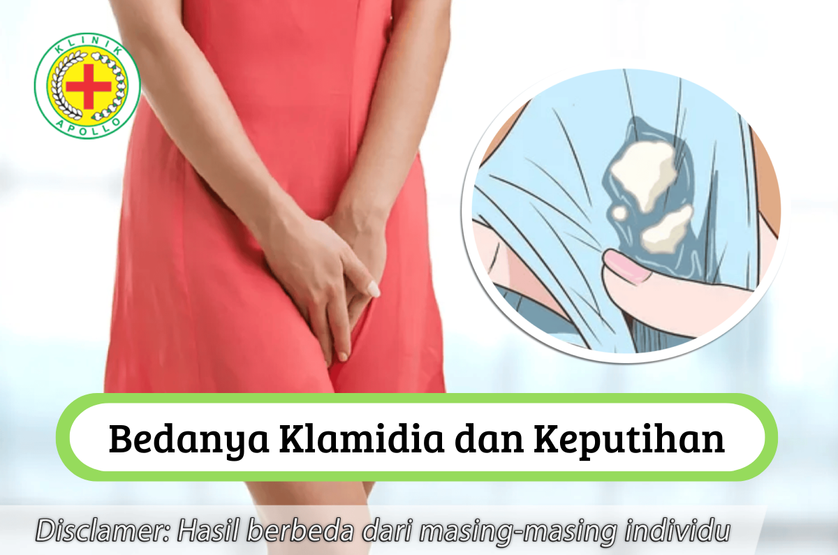 Ilustrasi Bedanya Klamidia dan Keputihan.