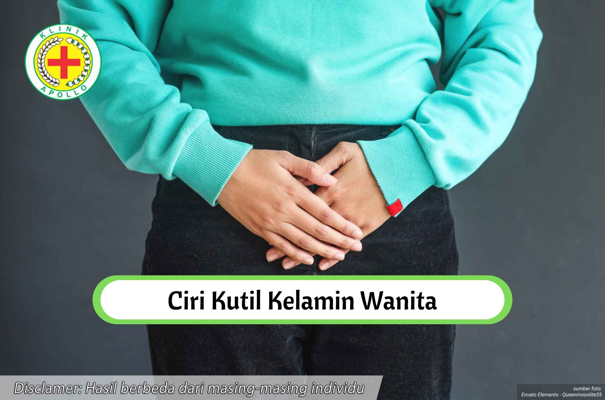 Ilustrasi Ciri Kutil Kelamin Wanita.