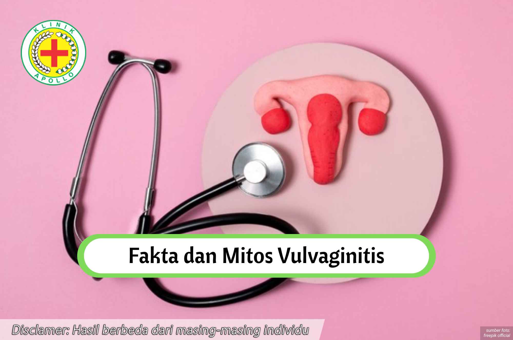 Ilustrasi Fakta dan Mitos Vulvaginitis.