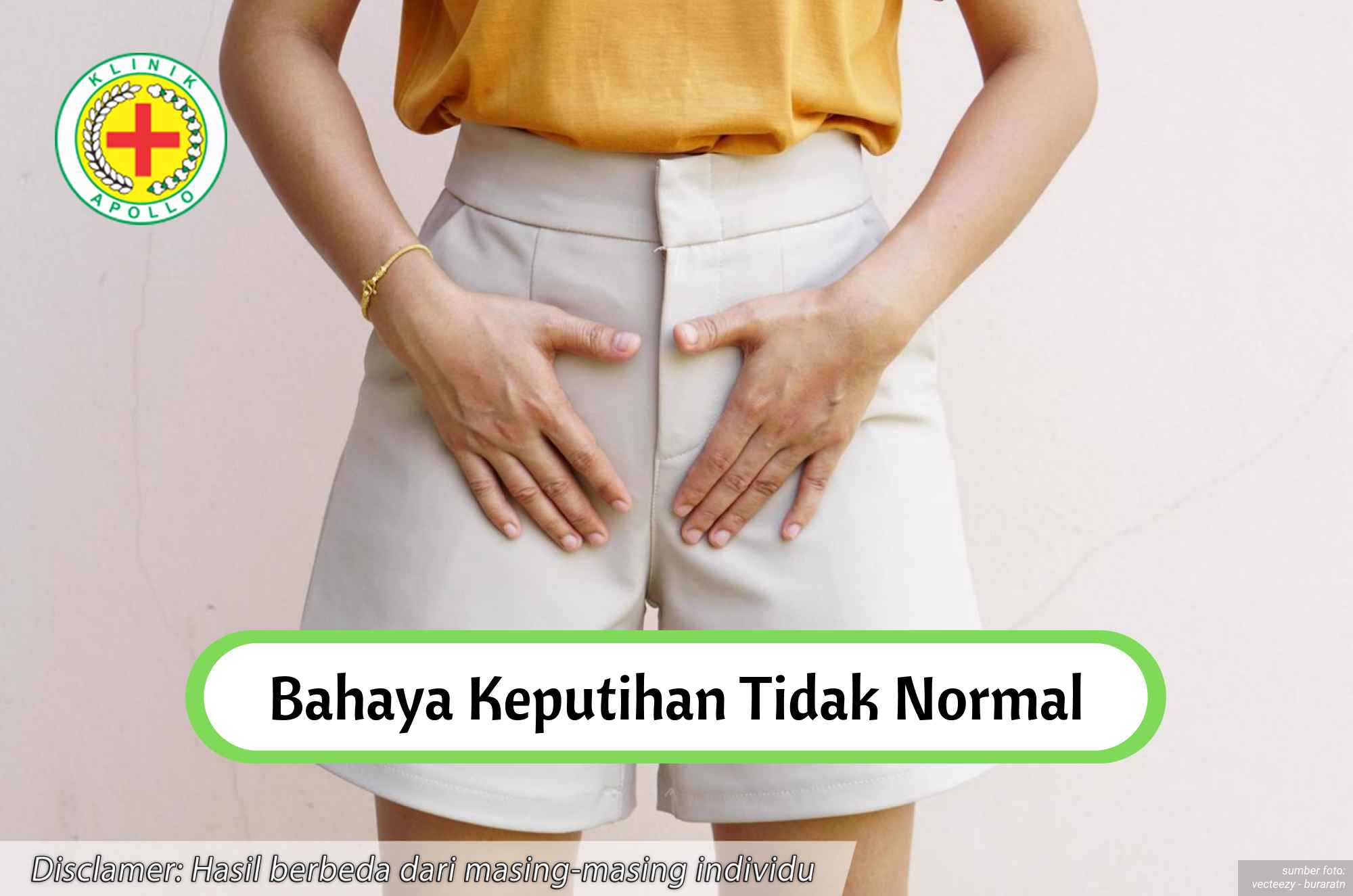 Ilustrasi Bahaya Keputihan Tidak Normal.