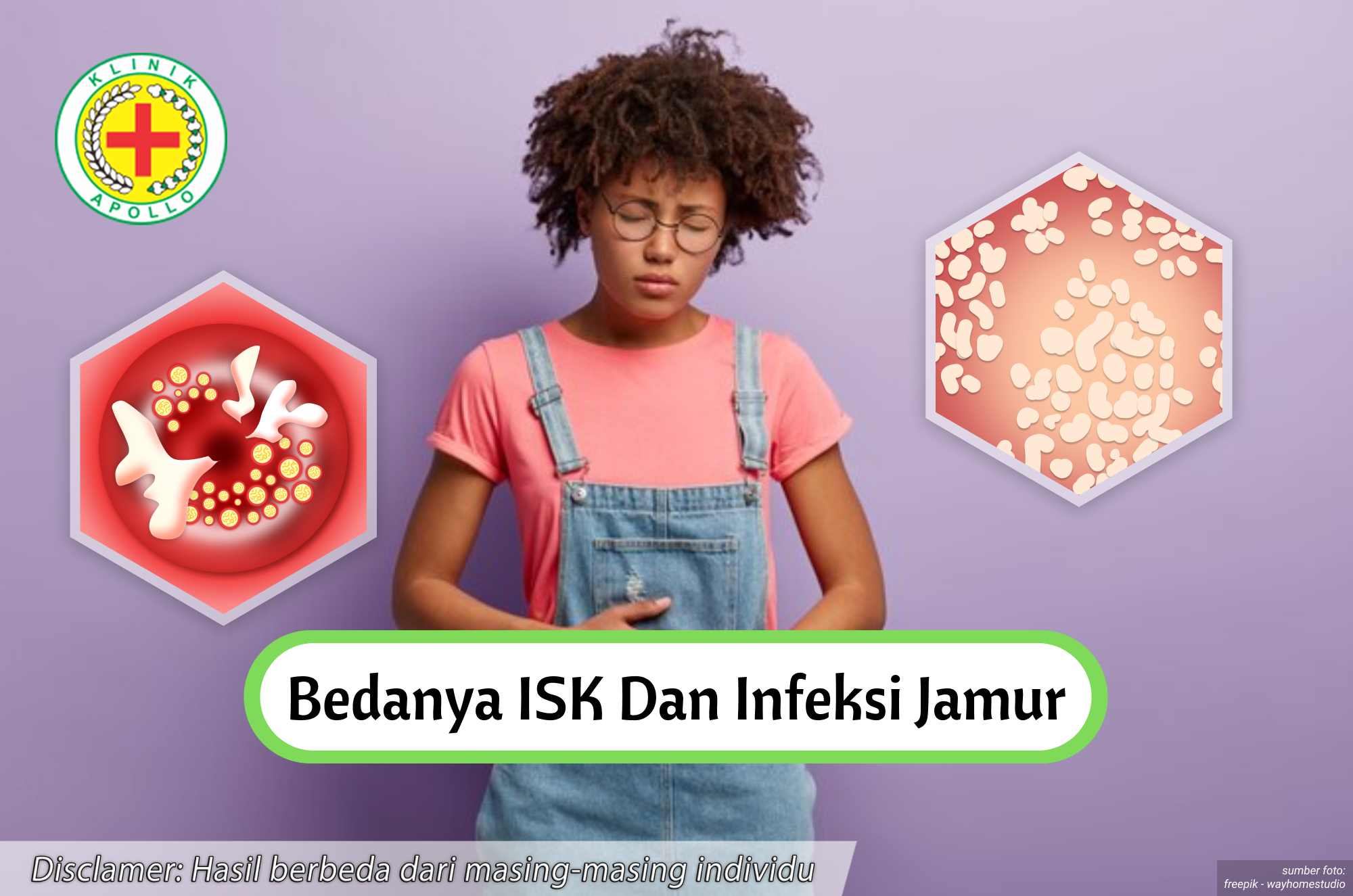 Bedanya ISK dan Infeksi Jamur Ilustrasi Bedanya ISK dan Infeksi Jamur.