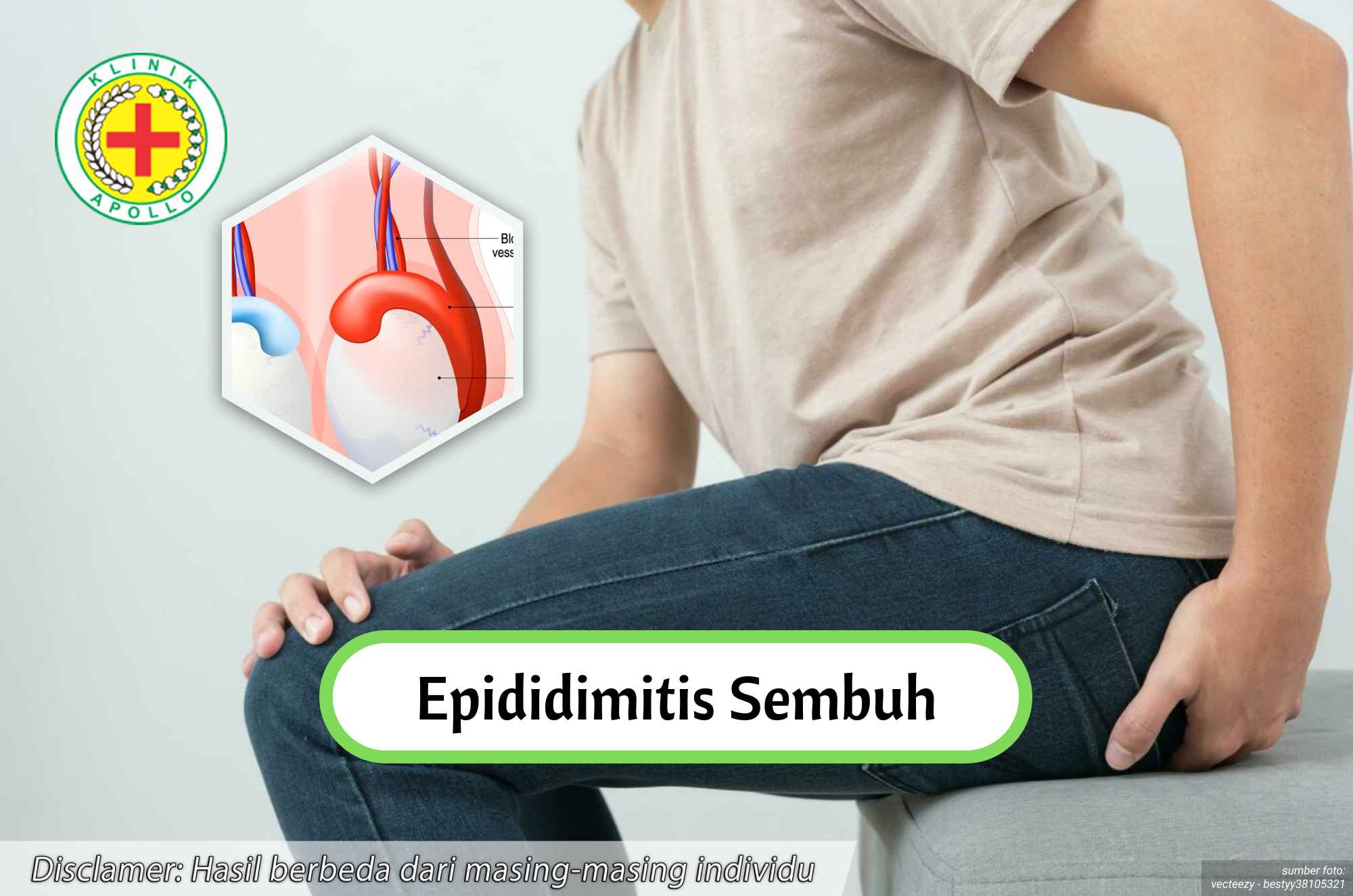 Ilustrasi Epididimitis Sembuh pada Pria Dewasa.