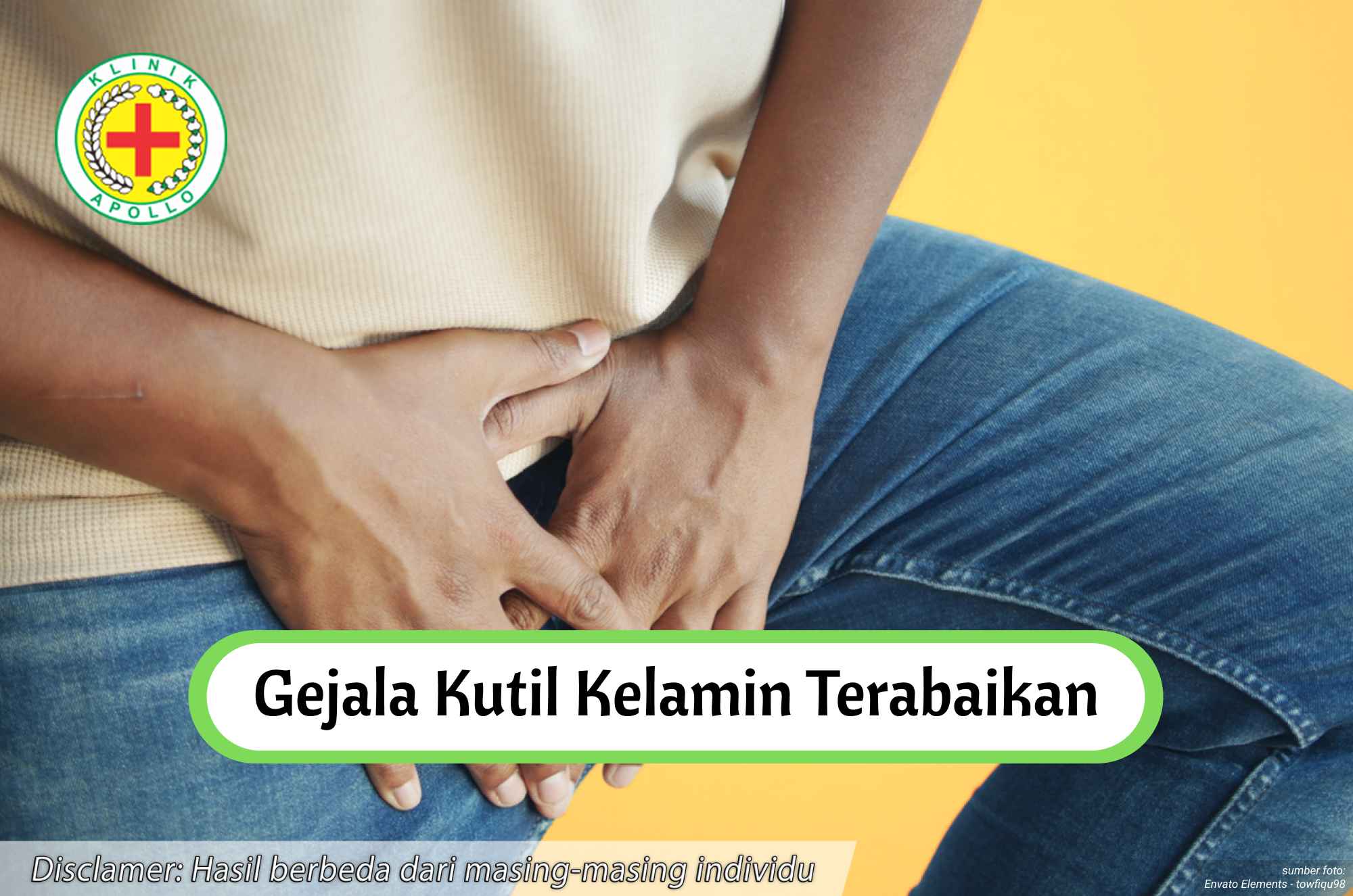 Ilustrasi Gejala Kutil Kelamin Terabaikan.