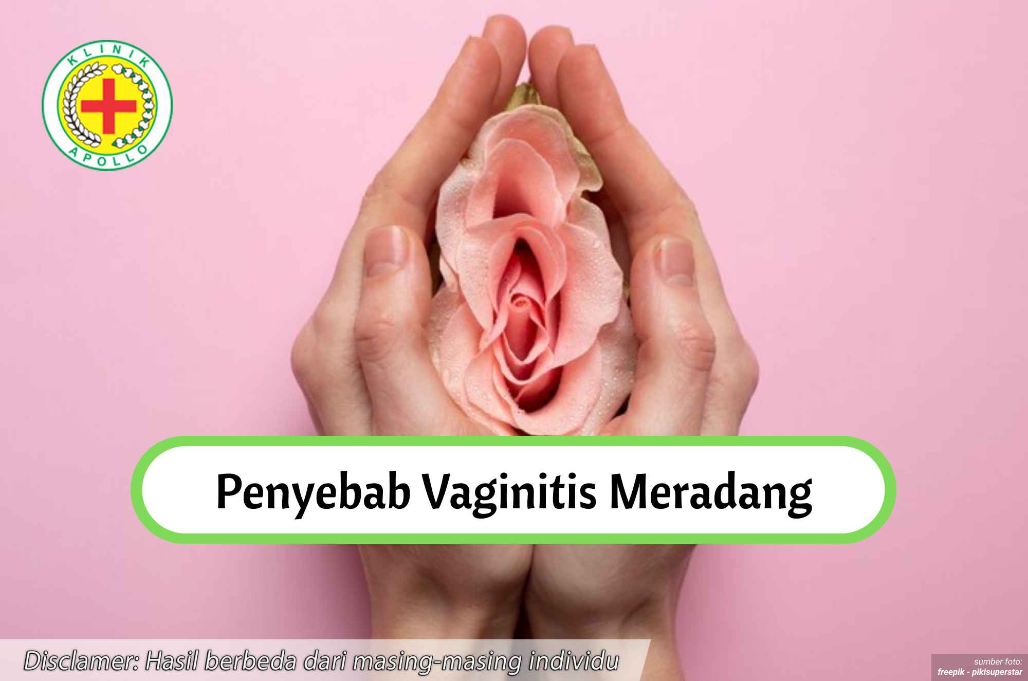 Ilustrasi Penyebab Vaginitis Meradang.