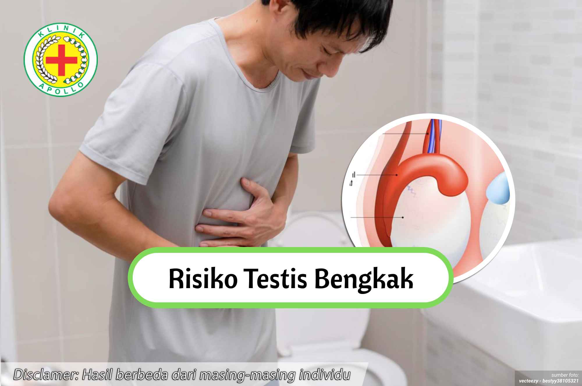 Ilustrasi Risiko Testis Bengkak.