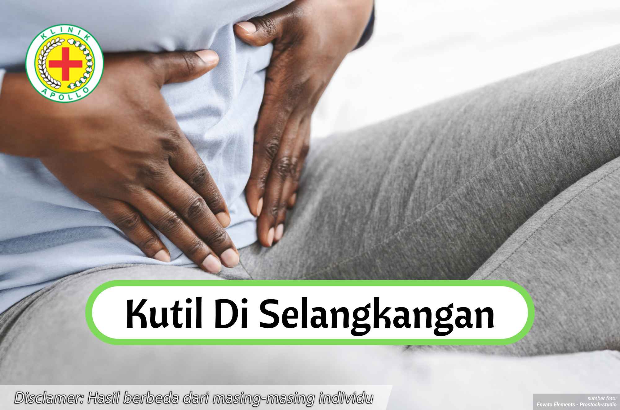 Ilustrasi Kutil di Selangkangan.