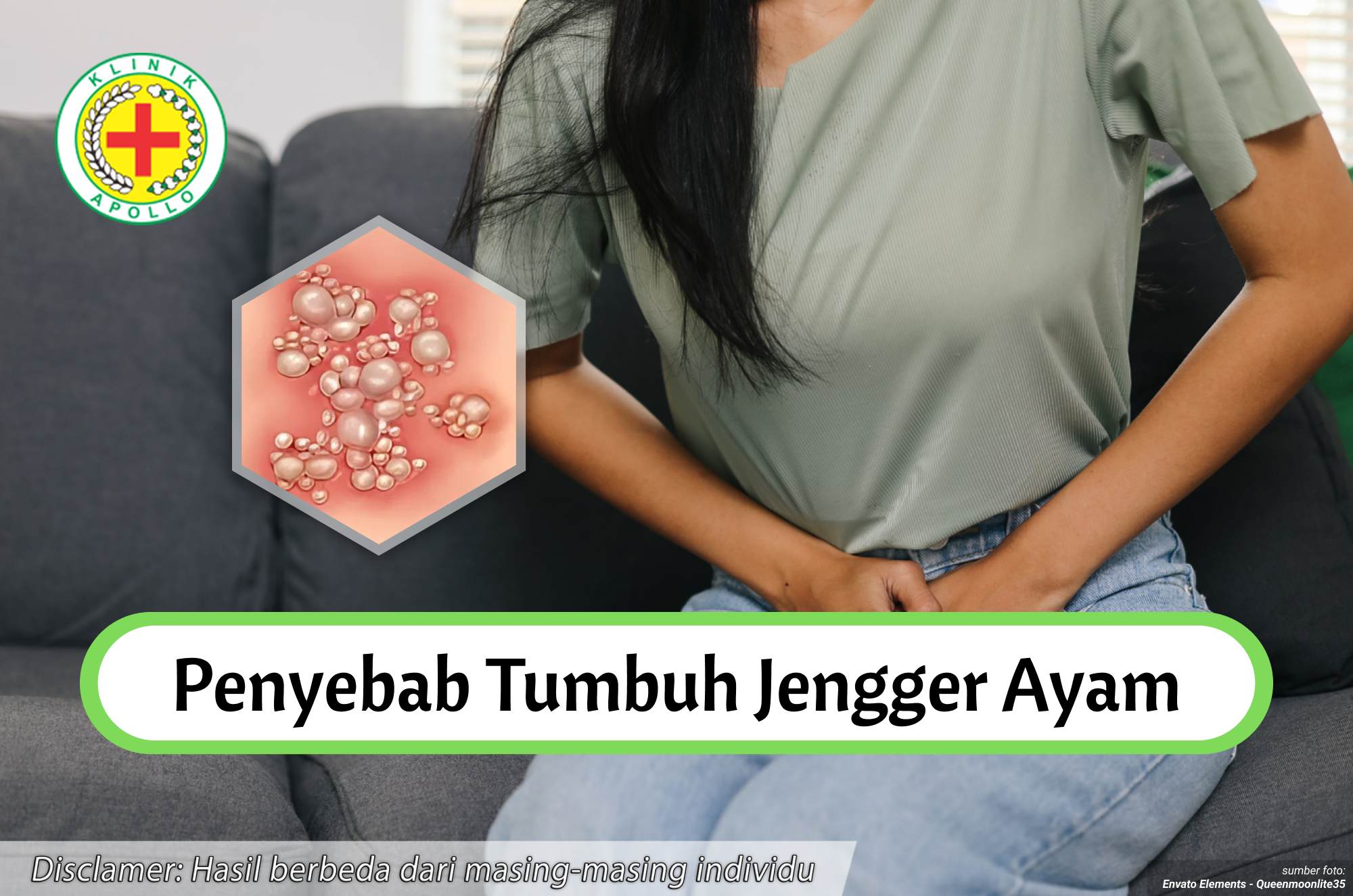 Ilustrasi Penyebab Tumbuh Jengger Ayam.