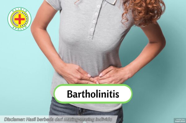 Gejala dan Penyebab Bartholinitis yang Wajib Diwaspadai Wanita | Klinik ...