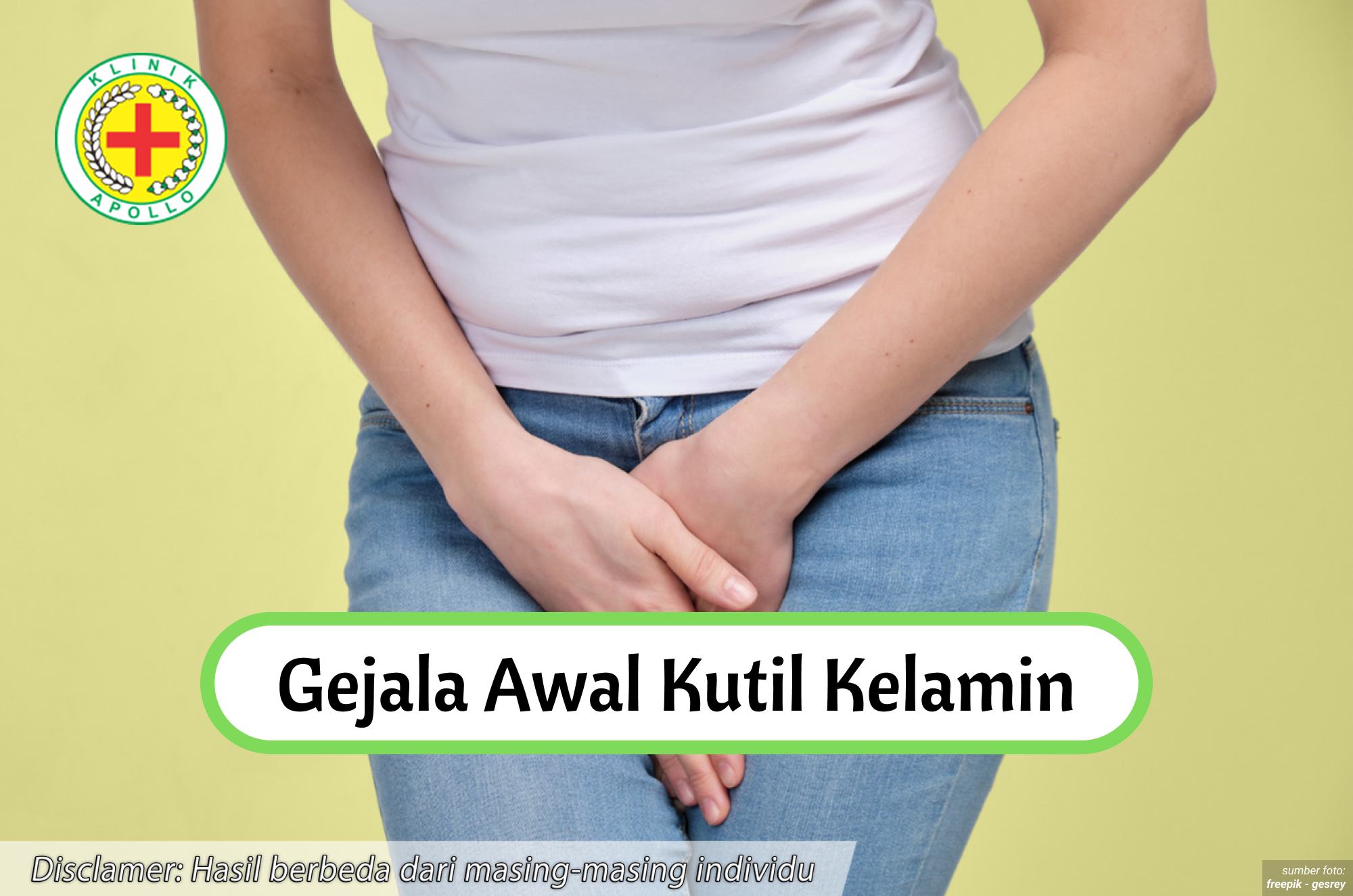 Ilustrasi Gejala Awal Kutil Kelamin.