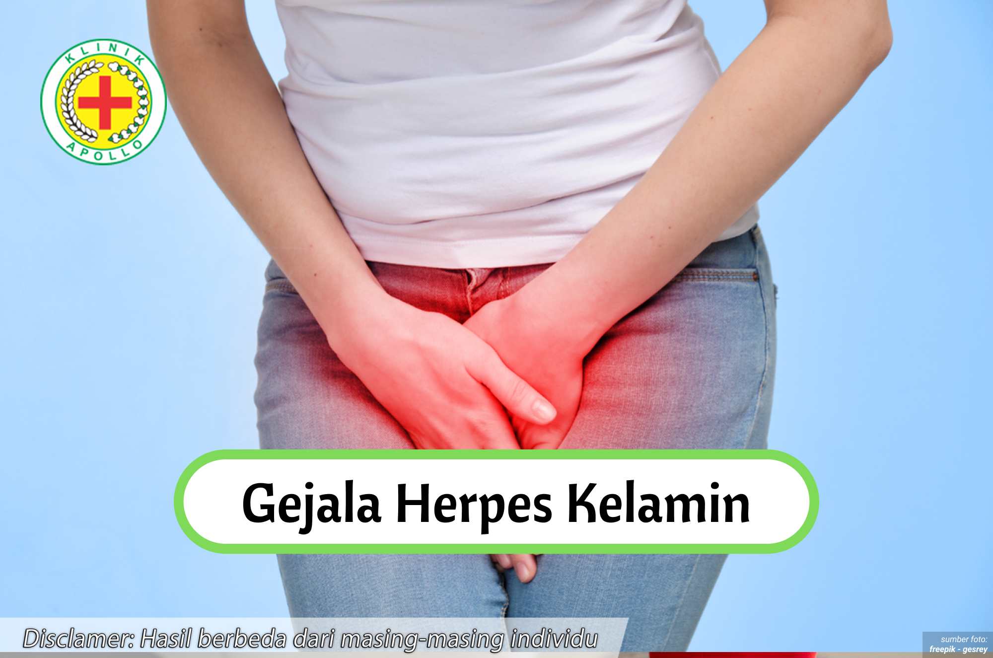 Ilustrasi Gejala Herpes Kelamin.