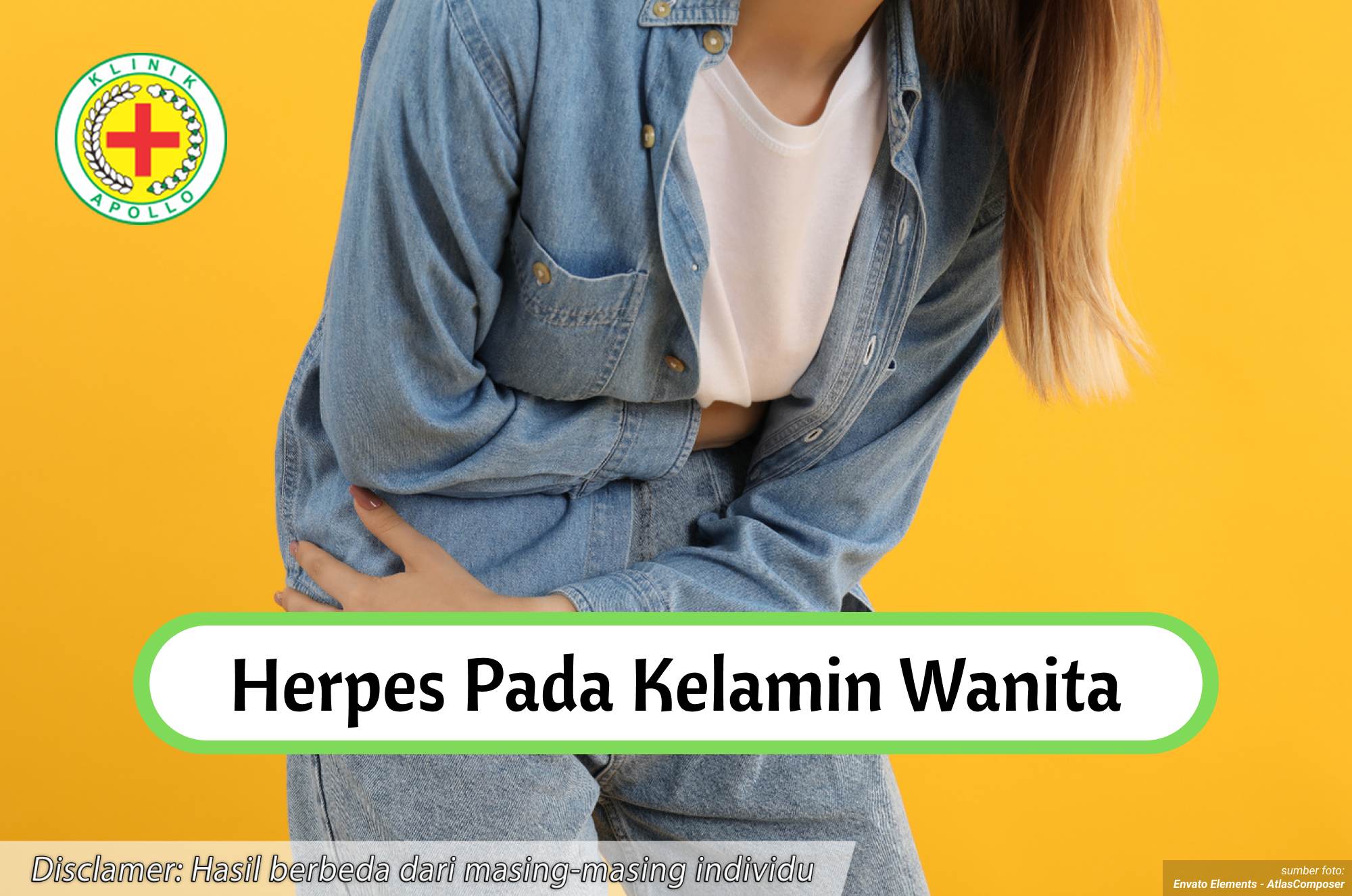 Ilustrasi Herpes pada Kelamin Wanita.