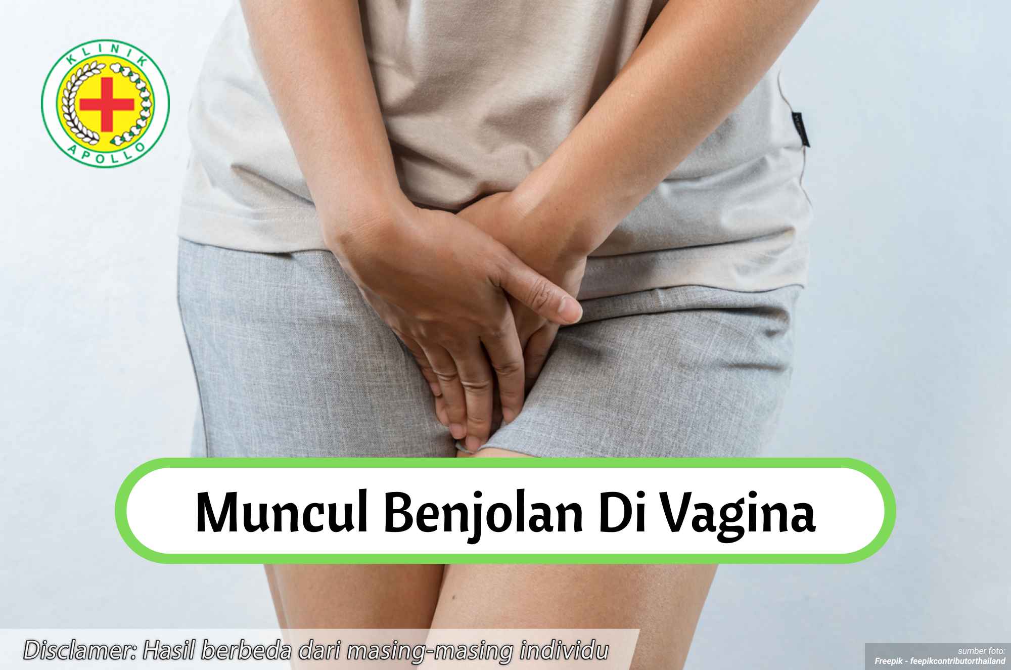 Ilustrasi Muncul Benjolan di Vagina.
