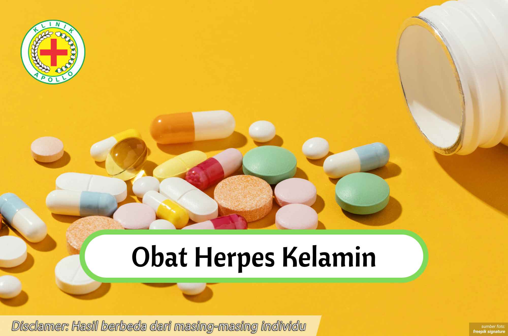 Ilustrasi Obat Herpes Kelamin.