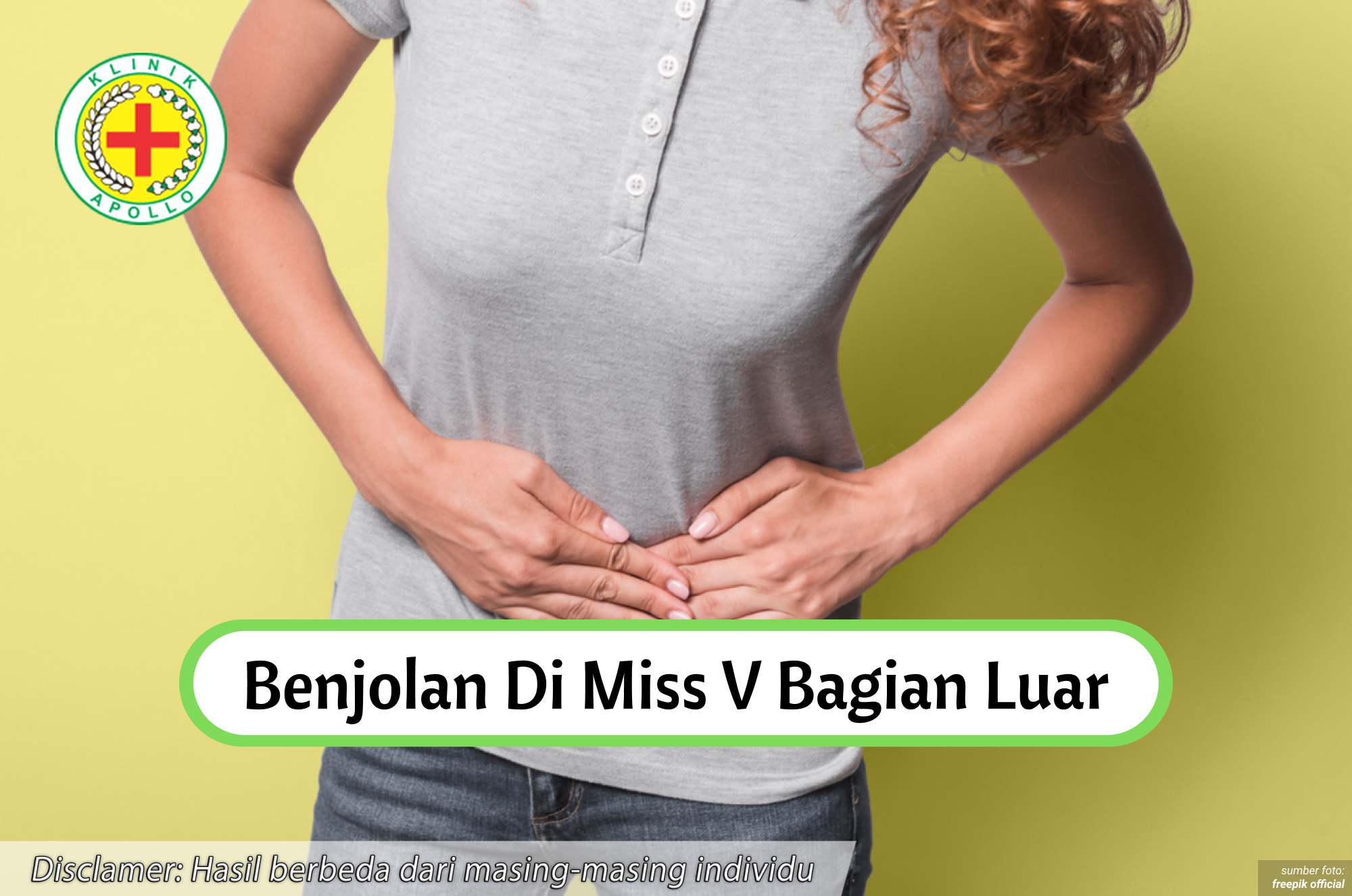 Ilustrasi Benjolan di Miss V Bagian Luar.