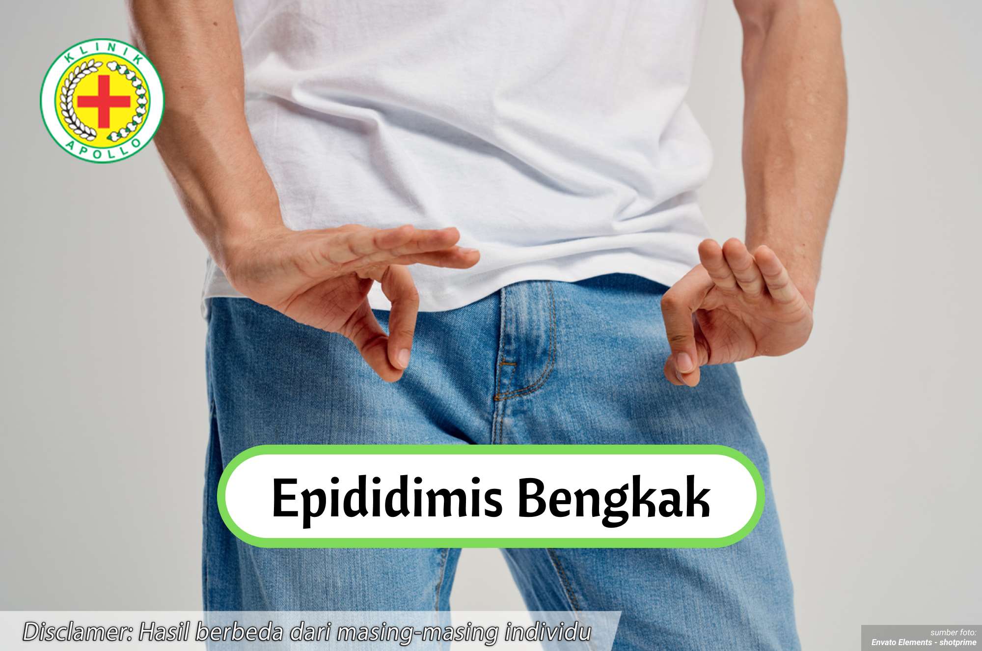 Ilustrasi Epididimitis Bengkak.