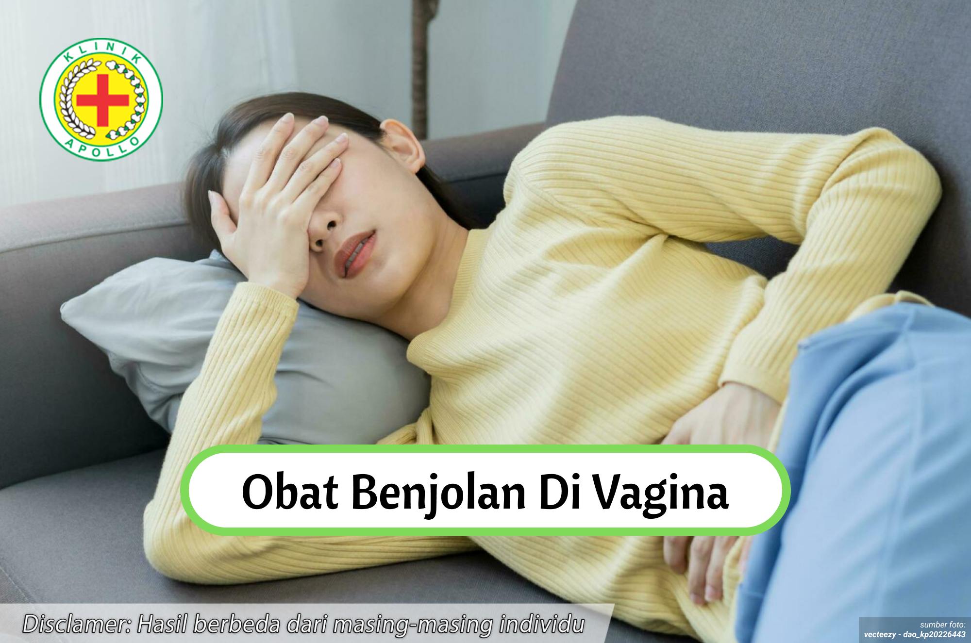 Ilustrasi Obat Benjolan di Vagina.