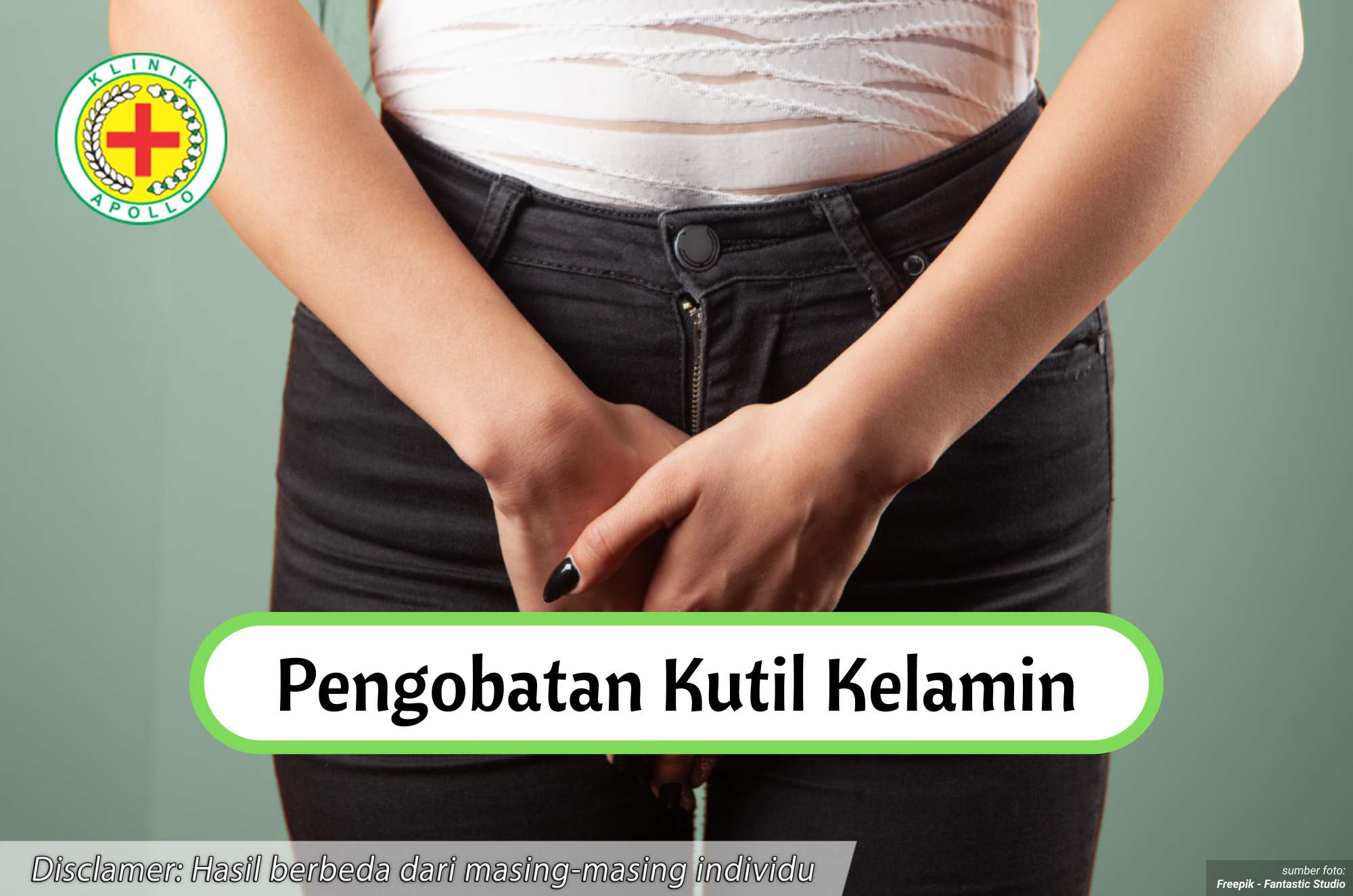 Ilustrasi Pengobatan Kutil Kelamin.