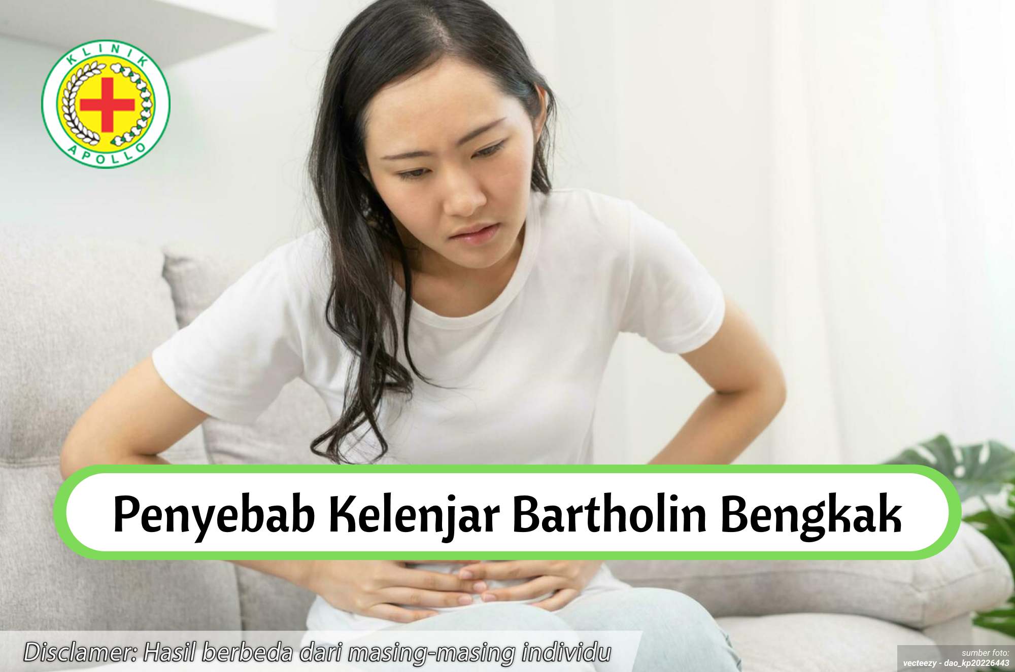 Ilustrasi Penyebab Kelenjar Bartholin Bengkak.
