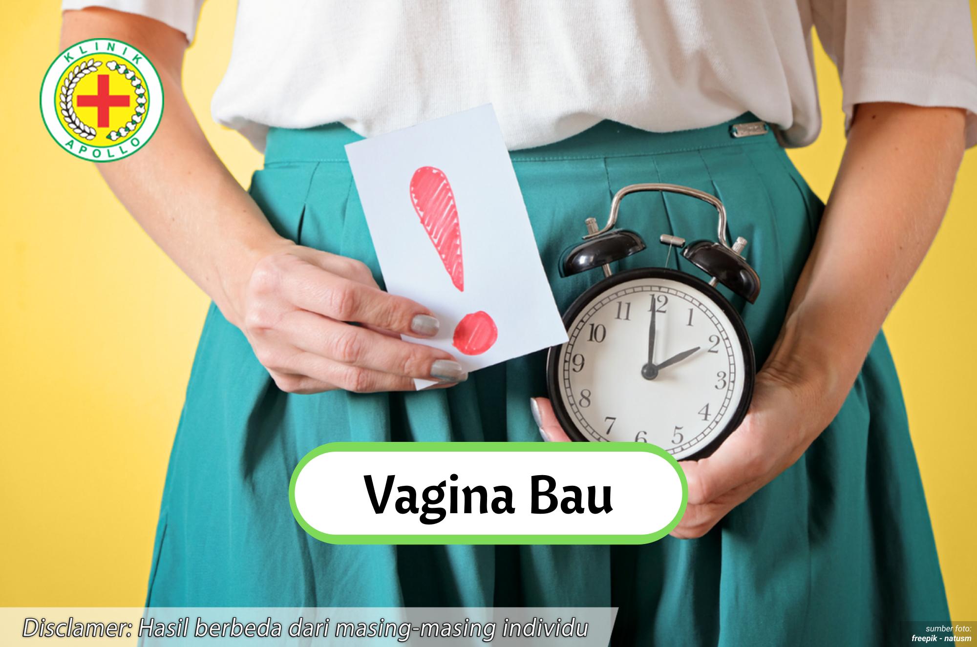 Ilustrasi Vagina Bau.