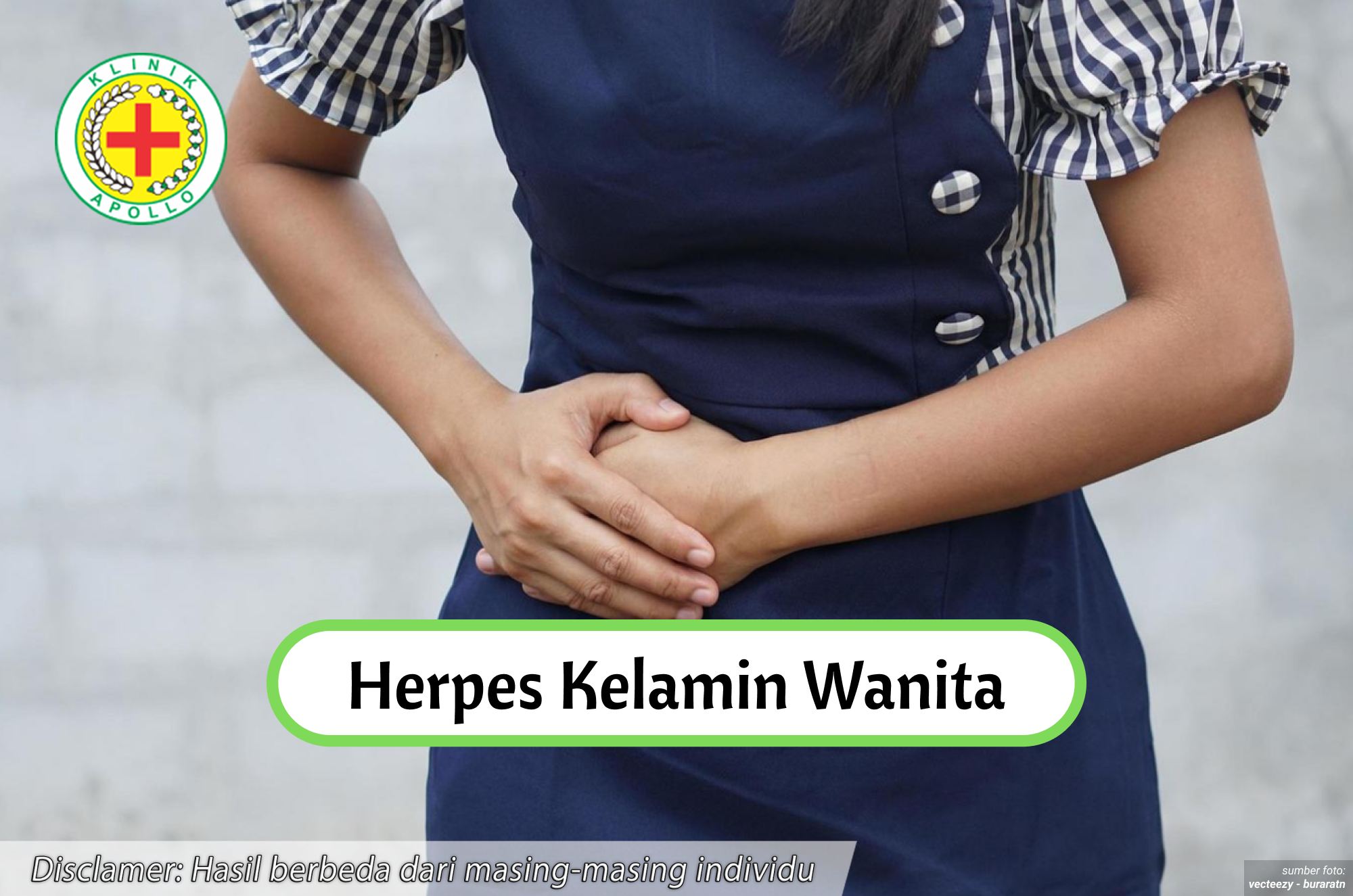 Ilustrasi Herpes Kelamin Wanita.
