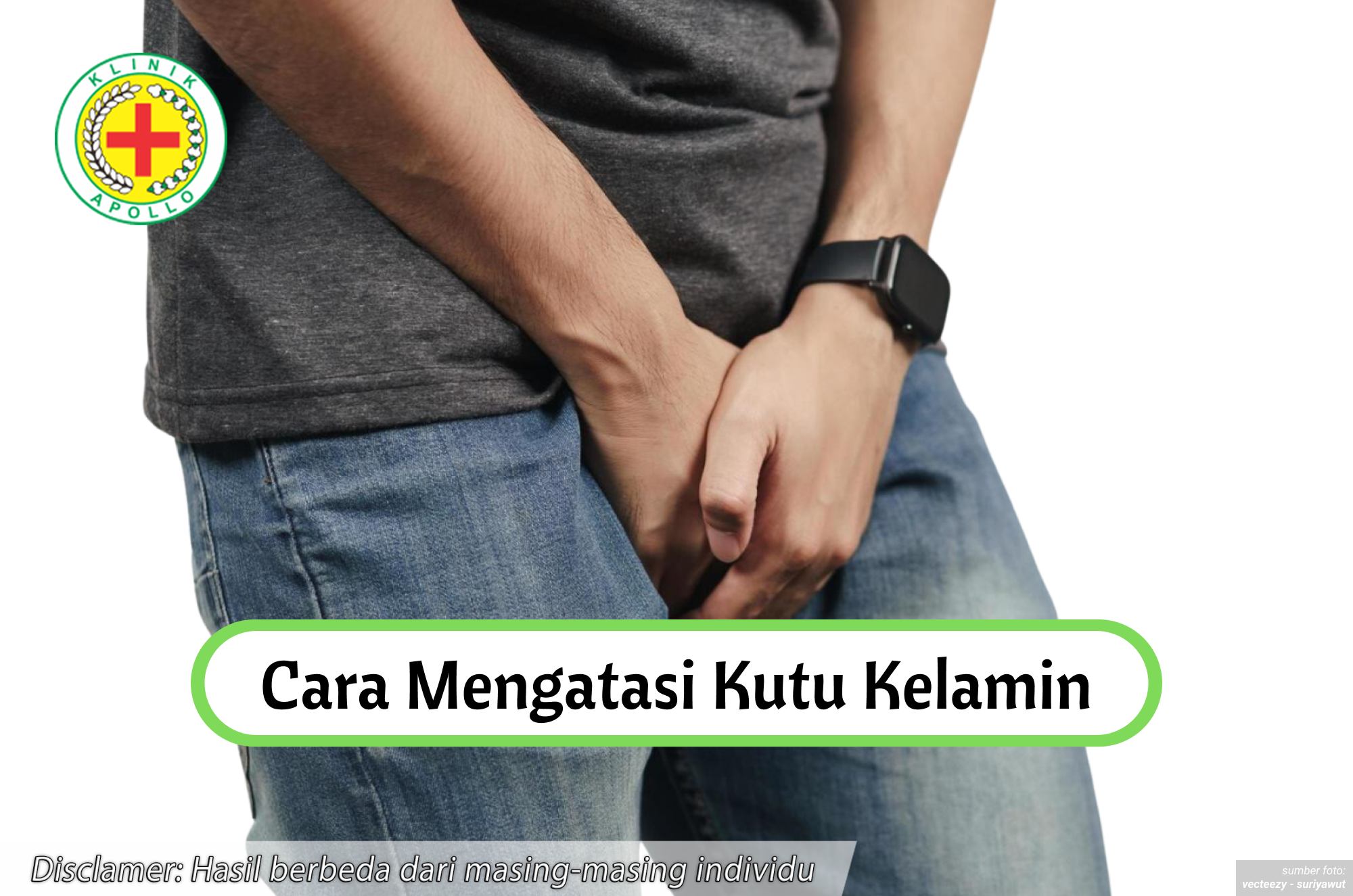 Ilustrasi Cara Mengatasi Kutu Kelamin.