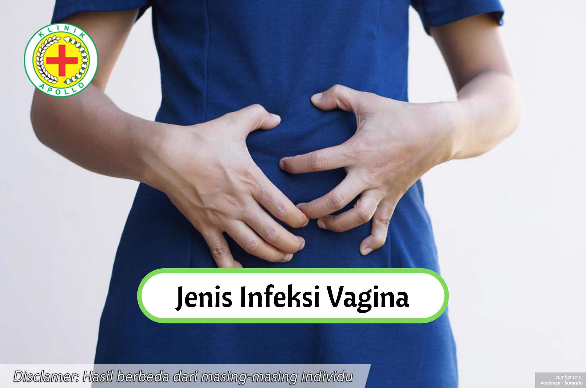 Ilustrasi Jenis Infeksi Vagina.