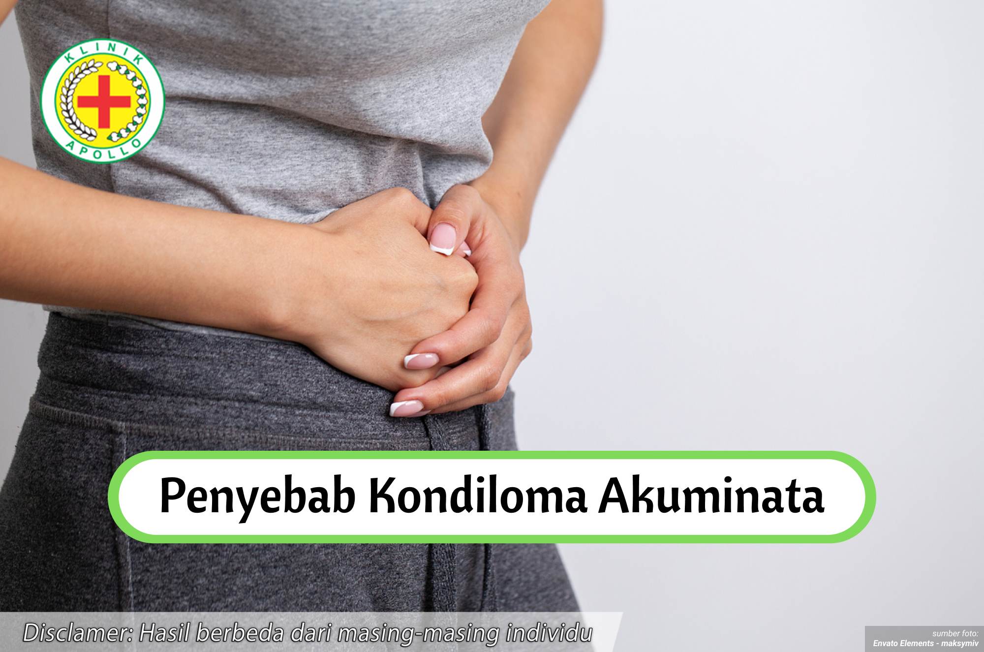 Ilustrasi Penyebab Kondiloma Akuminata.