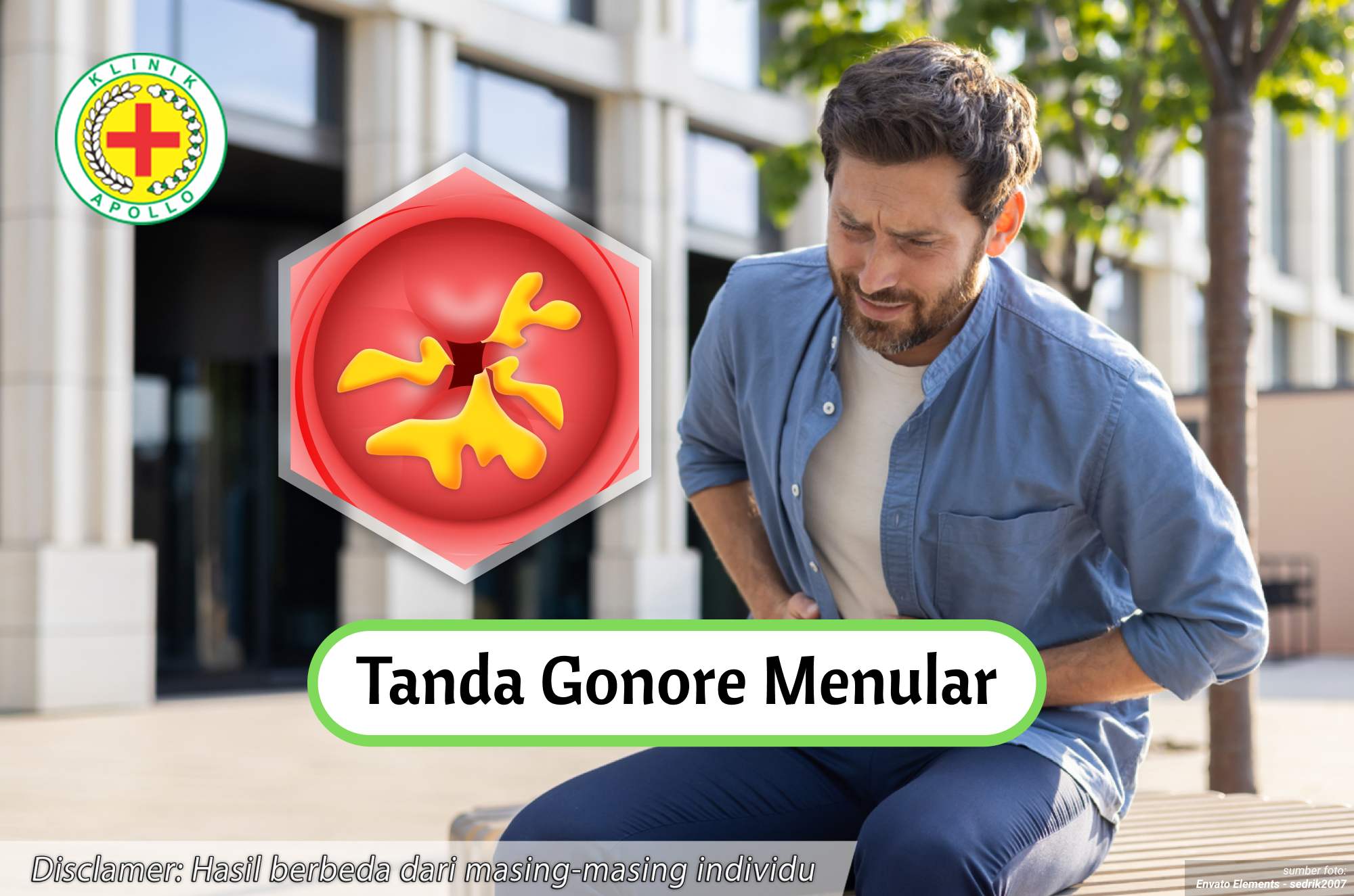 Ilustrasi Tanda Gonore Menular.