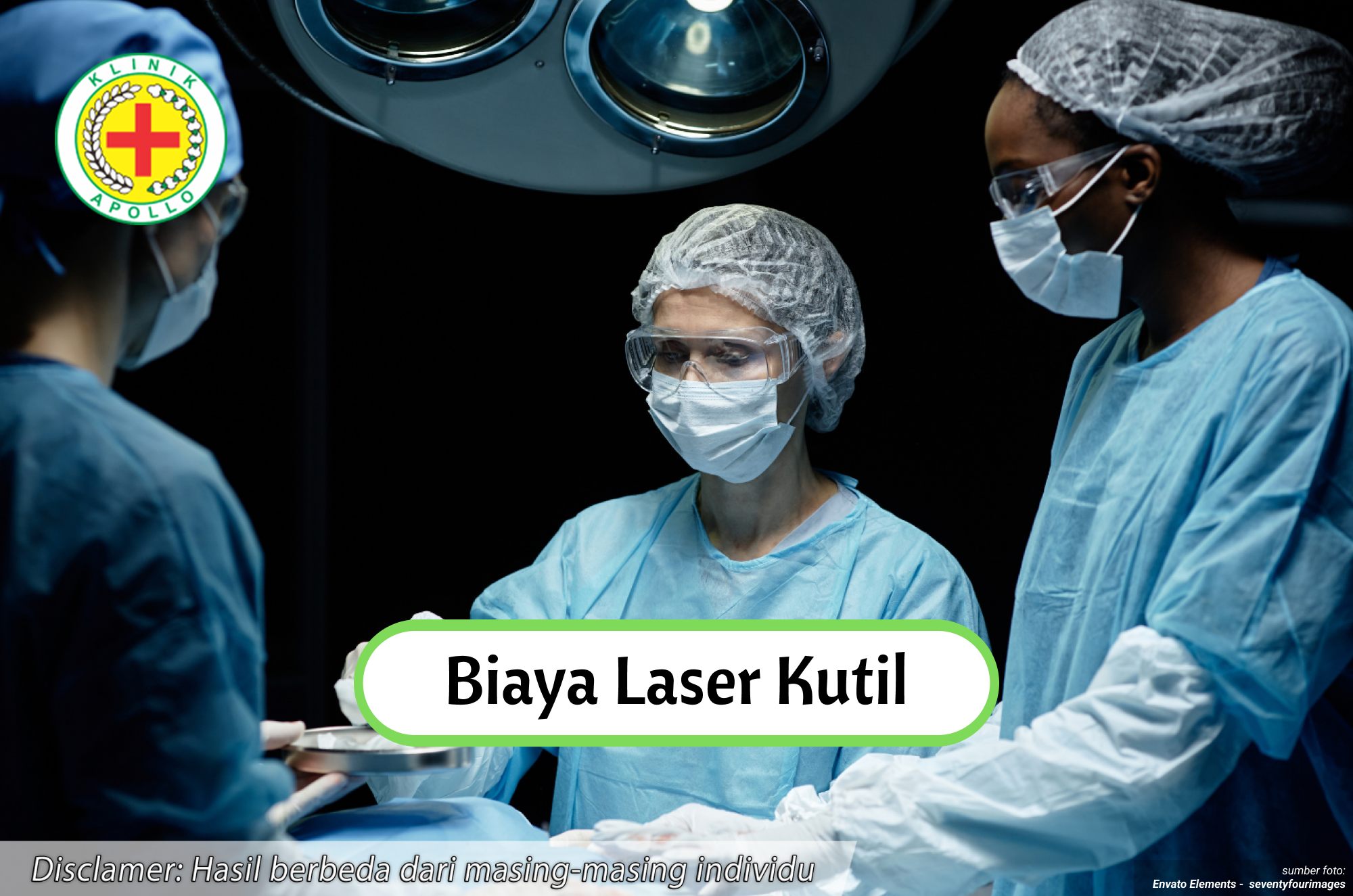 Ilustrasi Biaya Laser Kutil.