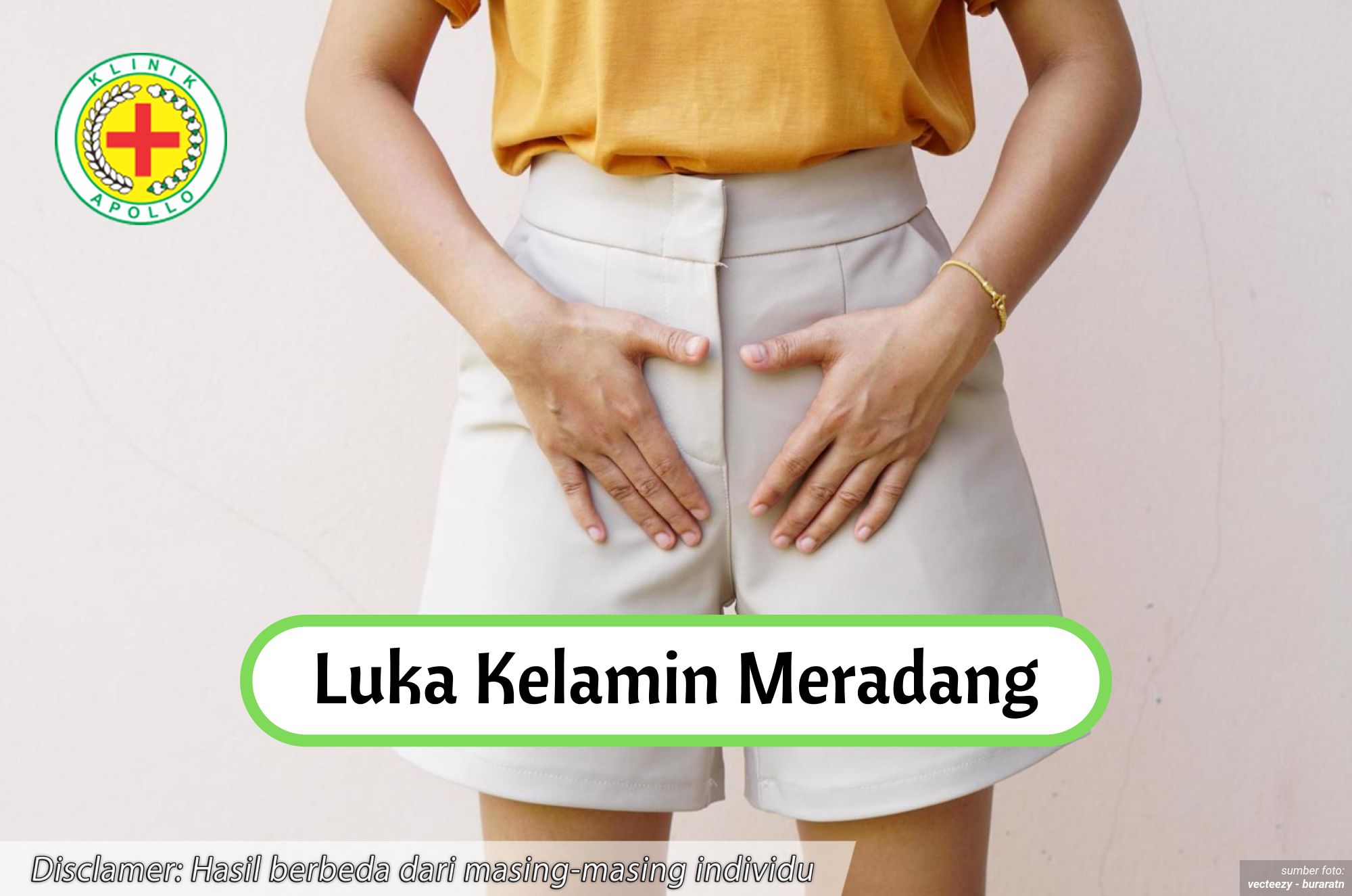 Ilustrasi Luka Kelamin Meradang.