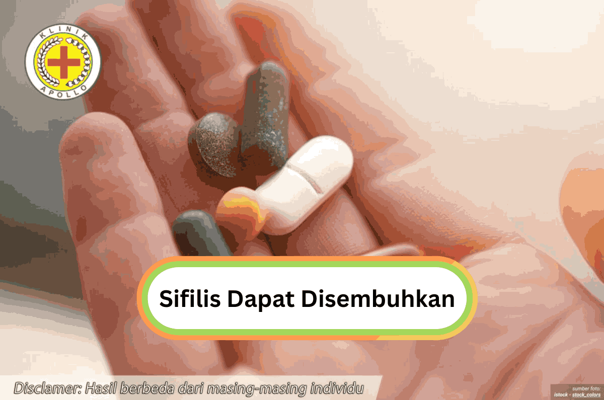 Ilustrasi Sifilis Dapat Disembuhkan.