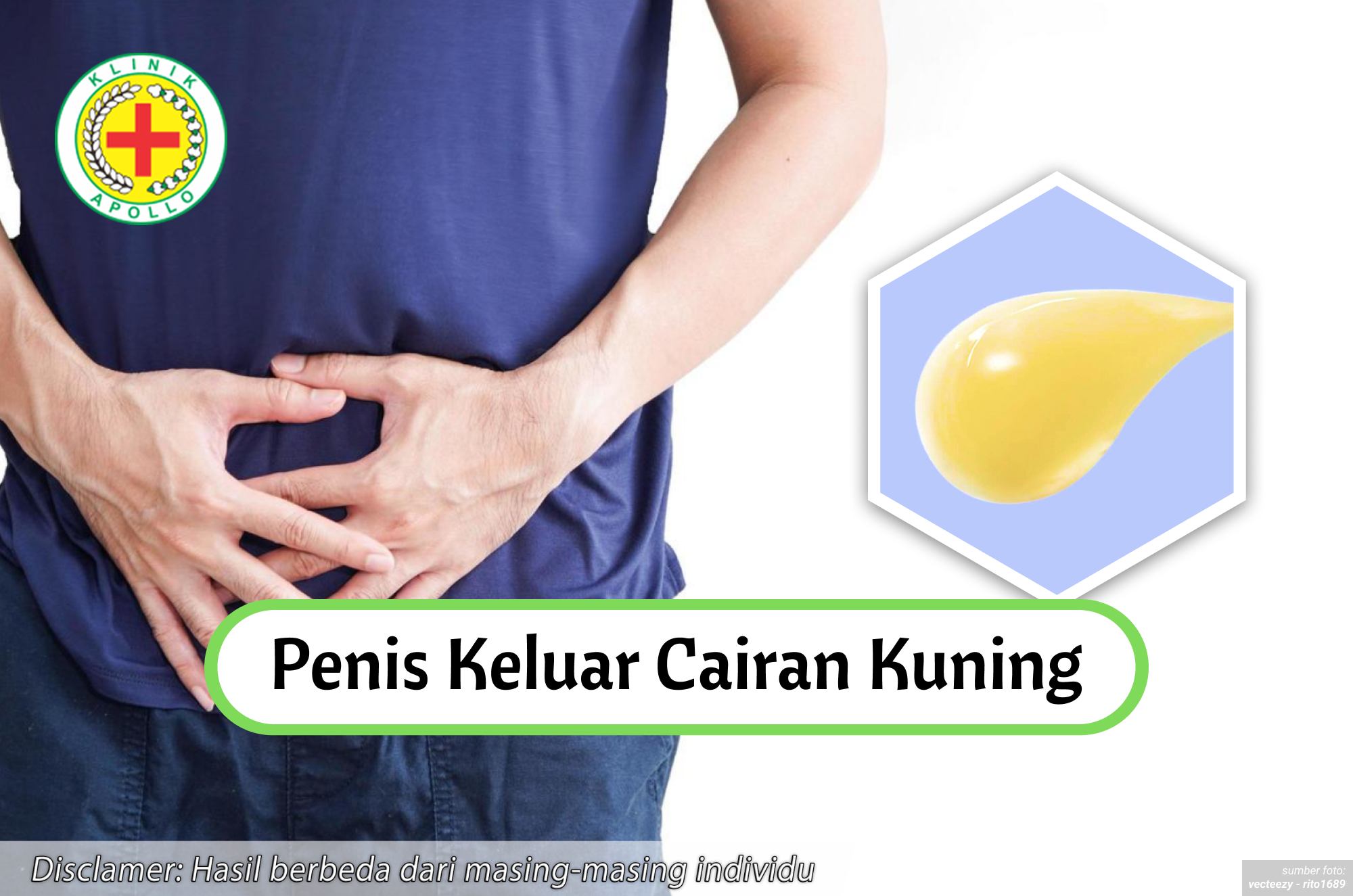 Ilustrasi Penis Keluar Cairan Kuning.