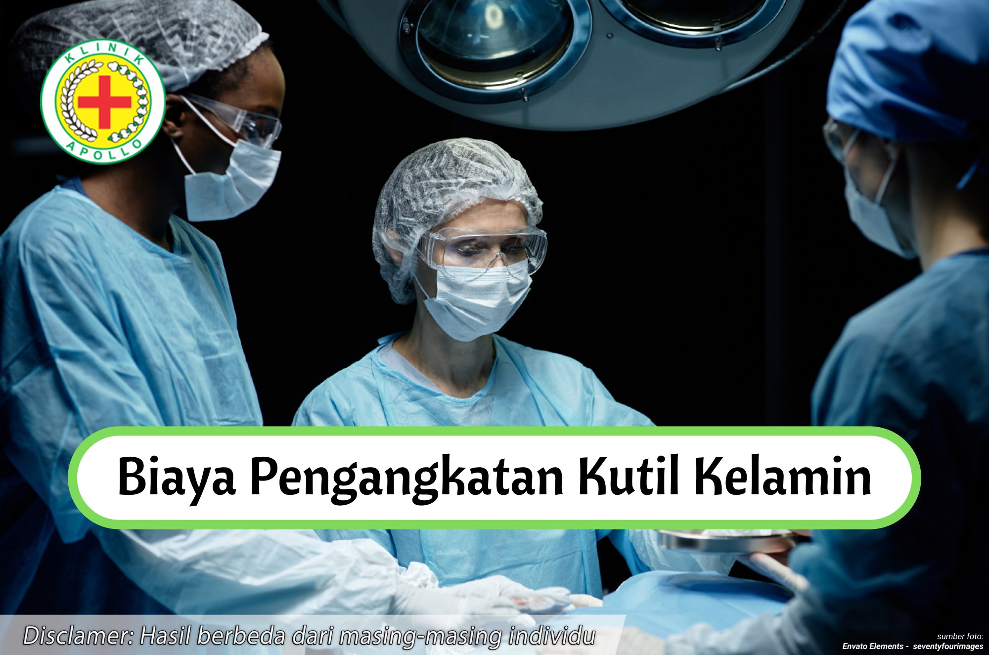 Ilustrasi Biaya Pengangkatan Kutil Kelamin.